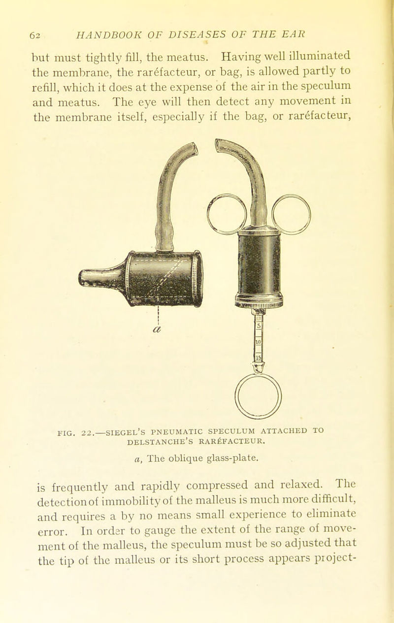 hut must tightly fill, the meatus. Having well illuminated the memhrane, the rarefacteur, or bag, is allowed partly to refill, which it does at the expense of the air in the speculum and meatus. The eye will then detect any movement in the membrane itself, especially if the bag, or rarefacteur, FIG. 22. SIEGEL'S PNEUMATIC SPECULUM ATTACHED TO delstanche's rarefacteur. a, The oblique glass-plate. is frequently and rapidly compressed and relaxed. The detectionof immobility of the malleus is much more difficult, and requires a by no means small experience to eliminate error. In order to gauge the extent of the range of move- ment of the malleus, the speculum must be so adjusted that the tip of the malleus or its short process appears pioject-