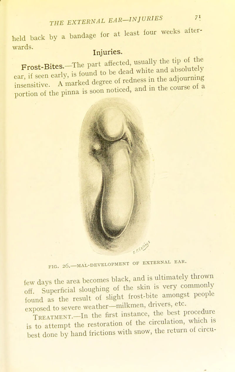 THE EXTERNAL EAE-INJURIBS 7'. held back by a bandage for at least four week, after- wards. . . Injuries. P^ost-Bltes-Tbepart^a^^^^^^^^ X^eeM redne. fn the adjourning porUon of the pinna is soon noticed, and m the course of a PIG, 26._MAL-DEVELOPMENT OF EXTERNAL EAR. few days the area becomes black, and .s ultimately thrown off Superficial sloughing of the skin is very coi.rmonly ?ound as the result of slight frost-bite amongst people exposed to severe weather-milkmen, drivers, etc. TREATMENT.-In the first hastance, the best procedure is to attempt the restoration of the circulation, which is best done by hand frictions with snow, the return of circu-