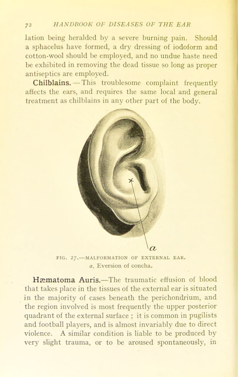 lation being heralded by a severe burning pain. Should a sphacelus have formed, a dry dressing of iodoform and cotton-wool should be employed, and no undue haste need be exhibited in removing the dead tissue so long as proper antiseptics are employed. Chilblains.—This troublesome complaint frequently affects the ears, and requires the same local and general treatment as chilblains in any other part of the body. Hssmatoma Auris.—The traumatic effusion of blood that takes place in the tissues of the external ear is situated in the majority of cases beneath the perichondrium, and the region involved is most frequently the upper posterior quadrant of the external surface ; it is common in pugilists and football players, and is almost invariablj' due to direct violence. A similar condition is liable to be produced by very slight trauma, or to be aroused si^ontaneousl}^, in FIG. 27.—MALFORMATION OF EXTERNAL EAR. a, Eversion of concha.