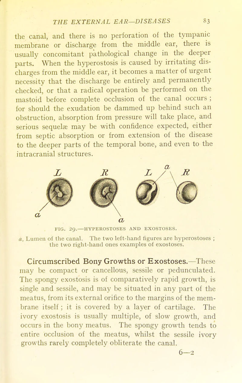 the canal, and there is no perforation of the tympanic membrane or discharge from the middle ear, there is usually concomitant pathological change in the deeper parts. When the hyperostosis is caused by irritating dis- charges from the middle ear, it becomes a matter of urgent necessity that the discharge be entirely and permanently checked, or that a radical operation be performed on the mastoid before complete occlusion of the canal occurs ; for should the exudation be dammed up behind such an obstruction, absorption from pressure will take place, and serious sequelae may be with confidence expected, either from septic absorption or from extension of the disease to the deeper parts of the temporal bone, and even to the intracranial structures. a FIG. 29. HYPEROSTOSES AND EXOSTOSES. a, Lumen of the canal. The two left-hand figures are hyperostoses ; the two right-hand ones examples of exostoses. Circumscribed Bony Growths or Exostoses.—These may be compact or cancellous, sessile or pedunculated. The spongy exostosis is of comparatively rapid growth, is single and sessile, and may be situated in any part of the meatus, from its external orifice to the margins of the mem- brane itself ; it is covered by a layer of cartilage. The ivory exostosis is usually multiple, of slow growth, and occurs in the bony meatus. The spongy growth tends to entire occlusion of the meatus, whilst the sessile ivory growths rarely completely obliterate the canal. 6—2