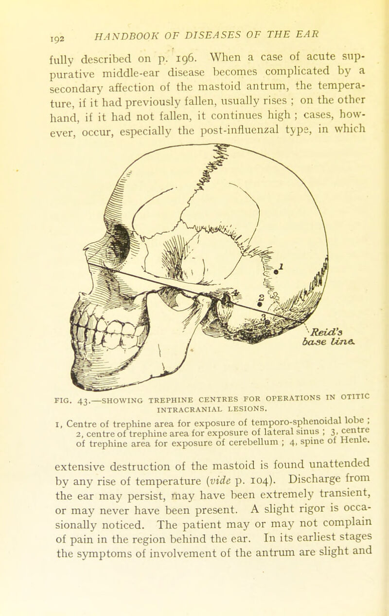 fully described on p. 196. When a case of acute sup- purative middle-ear disease becomes complicated by a secondary affection of the mastoid antrum, the tempera- ture, if it had previously fallen, usually rises ; on the other hand, if it had not fallen, it continues high ; cases, how- ever, occur, especially the post-infiuenzal type, in which RbvcL's Vuie. FIG. 43.—SHOWING TREPHINE CENTRES FOR OPERATIONS IN OTITIC INTRACRANIAL LESIONS. I, Centre of trephine area for exposure of temporo-splienoidal lobe ; 2, centre of trephine area for exposure of lateral smus ; 3, centre of trephine area for exposure of cerebellum ; 4, spine of Henle. extensive destruction of the mastoid is found unattended by any rise of temperature [vide p. 104). Discharge from the ear may persist, may have been extremely transient, or may never have been present. A slight rigor is occa- sionally noticed. The patient may or may not complain of pain in the region behind the ear. In its earliest stages the symptoms of involvement of the antrum are slight and