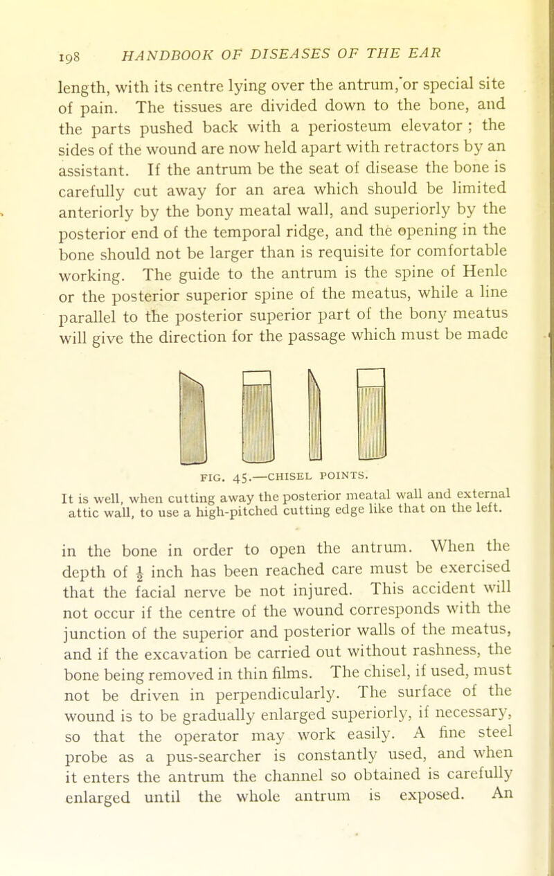 length, with its centre lying over the antrum,or special site of pain. The tissues are divided down to the bone, and the parts pushed back with a periosteum elevator ; the sides of the wound are now held apart with retractors by an assistant. If the antrum be the seat of disease the bone is carefully cut away for an area which should be limited anteriorly by the bony meatal wall, and superiorly by the posterior end of the temporal ridge, and the opening in the bone should not be larger than is requisite for comfortable working. The guide to the antrum is the spine of Henle or the posterior superior spine of the meatus, while a line parallel to the posterior superior part of the bony meatus will give the direction for the passage which must be made FIG. 45. CHISEL POINTS. It is well when cutting away the posterior meatal wall and external attic wall, to use a high-pitched cutting edge like that on the left. in the bone in order to open the antrum. When the depth of 1 inch has been reached care must be exercised that the facial nerve be not injured. This accident will not occur if the centre of the wound corresponds with the junction of the superior and posterior walls of the meatus, and if the excavation be carried out without rashness, the bone being removed in thin films. The chisel, if used, must not be driven in perpendicularly. The surface of the wound is to be gradually enlarged superiorly, if necessary, so that the operator may work easily. A fine steel probe as a pus-searcher is constantly used, and when it enters the antrum the channel so obtained is carefully enlarged until the whole antrum is exposed. An