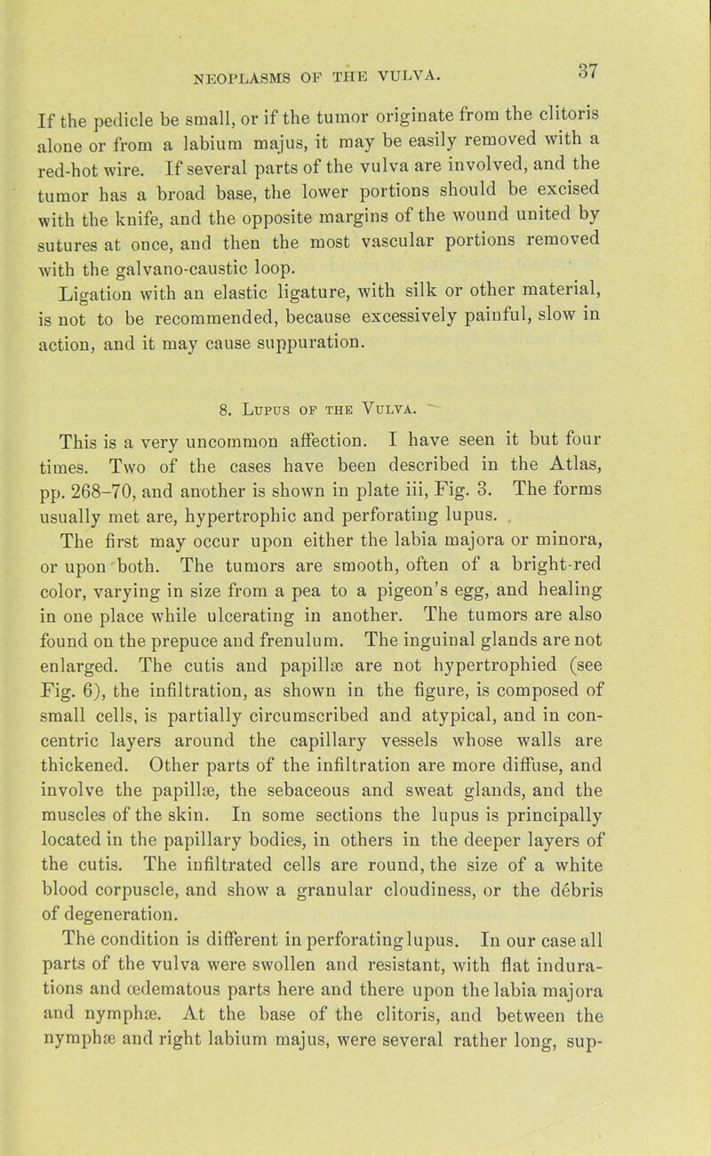 If the pedicle be small, or if the tumor originate from the clitoris alone or from a labium majus, it may be easily removed with a red-hot wire. If several parts of the vulva are involved, and the tumor has a broad base, the lower portions should be excised with the knife, and the opposite margins of the wound united by sutures at once, and then the most vascular portions removed with the galvano-caustic loop. Ligation with an elastic ligature, with silk or other material, is not to be recommended, because excessively painful, slow in action, and it may cause suppuration. 8. Lupus of the Vulva. This is a very uncommon affection. I have seen it but four times. Two of the cases have been described in the Atlas, pp. 268-70, and another is shown in plate iii, Fig. 3. The forms usually met are, hypertrophic and perforating lupus. The first may occur upon either the labia majora or minora, or upon both. The tumors are smooth, often of a bright-red color, varying in size from a pea to a pigeon's egg, and healing in one place while ulcerating in another. The tumors are also found on the prepuce and frenulum. The inguinal glands are not enlarged. The cutis and papilla? are not hypertrophied (see Fig. 6), the infiltration, as shown in the figure, is composed of small cells, is partially circumscribed and atypical, and in con- centric layers around the capillary vessels whose walls are thickened. Other parts of the infiltration are more diffuse, and involve the papillse, the sebaceous and sweat glands, and the muscles of the skin. In some sections the lupus is principally located in the papillary bodies, in others in the deeper layers of the cutis. The infiltrated cells are round, the size of a white blood corpuscle, and show a granular cloudiness, or the debris of degeneration. The condition is different in perforating lupus. In our case all parts of the vulva were swollen and resistant, with flat indura- tions and cedematous parts here and there upon the labia majora and nymphse. At the base of the clitoris, and between the nymphse and right labium majus, were several rather long, sup-
