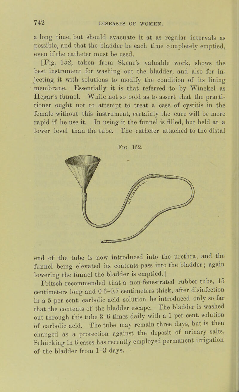 a long time, but should evacuate it at as regular intervals as possible, and that the bladder be each time completely emptied, even if the catheter must be used. [Fig. 152, taken from Skene's valuable work, shows the best instrument for washing out the bladder, and also for in- jecting it with solutions to modify the condition of its lining membrane. Essentially it is that referred to by Winckel as Hegar's funnel. While not so bold as to assert that the practi- tioner ought not to attempt to treat a case of cystitis in the female without this instrument, certainly the cure will be more rapid if he use it. In using it the funnel is filled, but held at a lower level than the tube. The catheter attached to the distal Fig. 152. end of the tube is now introduced into the urethra, and the funnel being elevated its contents pass into the bladder; again lowering the funnel the bladder is emptied.] Fritsch recommended that a non-fenestrated rubber tube, 15 centimeters long and 0 6-0.7 centimeters thick, after disinfection in a 5 per cent, carbolic acid solution be introduced only so far that the contents of the bladder escape. The bladder is washed out through this tube 3-6 times daily with a 1 per cent, solution of carbolic acid. The tube may remain three days, but is then changed as a protection against the deposit of urinary salts. Schiicking in 6 cases has recently employed permanent irrigation of the bladder from 1-3 days.