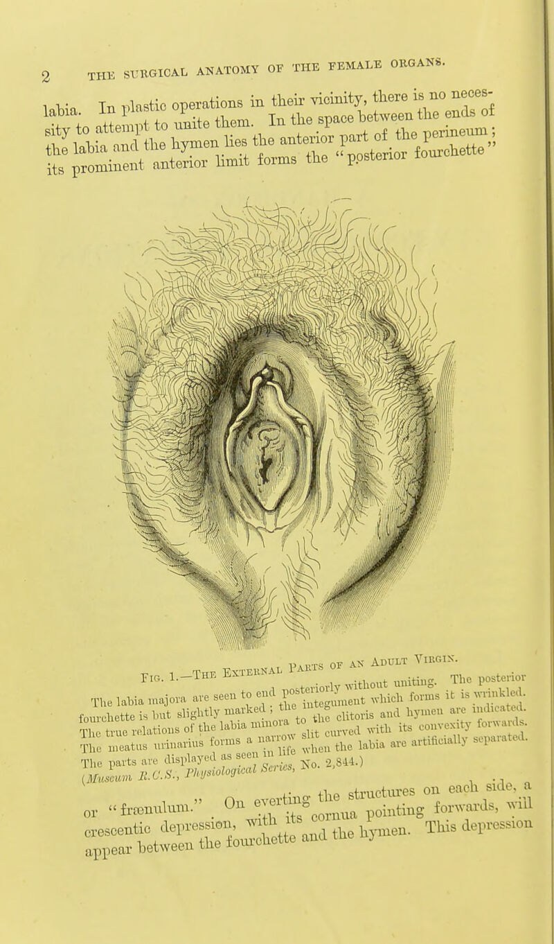1 Tt. ..lastic operations in their -dcinity, tTiere is no neces- ? in P 0 ulite them. In the space between the ends of Pi UTS or AX Adult Virgis. The labia majora are seen to eml l^^lesLent foms is ionvMM sligl^tly marked the lu . ^^.^ ^^^^^ ^^^^^^^^^ ^ , Heated. S true rdatioBSol'the labia uunoia to tU ^^.^^ .^^ ,y fo,va d . il;: meatus uriuarius forms a i^r W ^^^^ ,,,ifiaally separated. The parts are displayed as see r m (;if«.L*m lies., nvswlogtcal Saves, o. fhP structm-es on each side, a „, ..tonulmn. Ou ^^^f ^Mng taWs, will
