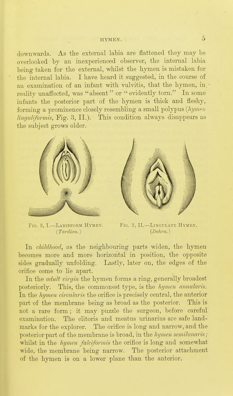 do-umvai-ds. As the external labia are flattened they may be overlooked by an inexperienced observer, the internal labia being taken for the external, wliilst the hymen is mistaken for the internal labia. I have heard it suggested, in the coui'se of an examination of an infant with vulvitis, that the hymen, in. reahty unaffected, was absent or  evidently torn. In some infants the posterior part of the hymen is thick and fleshy, forming a prominence closely resembling a small polypus (Jiymfii ling IIIiformis, Kg. 3, II.). This condition always disappears as the subject grows older. Fig. 3, I.—Labiefoiim Hymex. Fig. 3, II.—Linoulate Hymen. (Tardicu.) (Dohrn.) In childhood, iis the neighboiu-ing parts widen, the hymen becomes more and more horizontal in position, the opposite sides gradually unfolding. Lastly, later on, the edges of the orifice come to lie apart. In the adult virgin the hymen forms a ring, generally broadest posteriorly. This, the commonest type, is the hymen annularis. In the hymen circiilaris the orifice is precisely central, the anterior part of the membrane being as broad as the posterior. This is not a rare form ; it may puzzle the surgeon, before careful examination. The clitoris and meatus m-inarius are safe land- marks for the explorer. The orifice is long and narrow, and the posterior part of the membrane is broad, in the hymen semilunaris; whilst in the hymen fakiformis the orifice is long and somewhat wide, the membrane being narrow. The posterior attachment of the hymen is on a lower plane than the anterior.