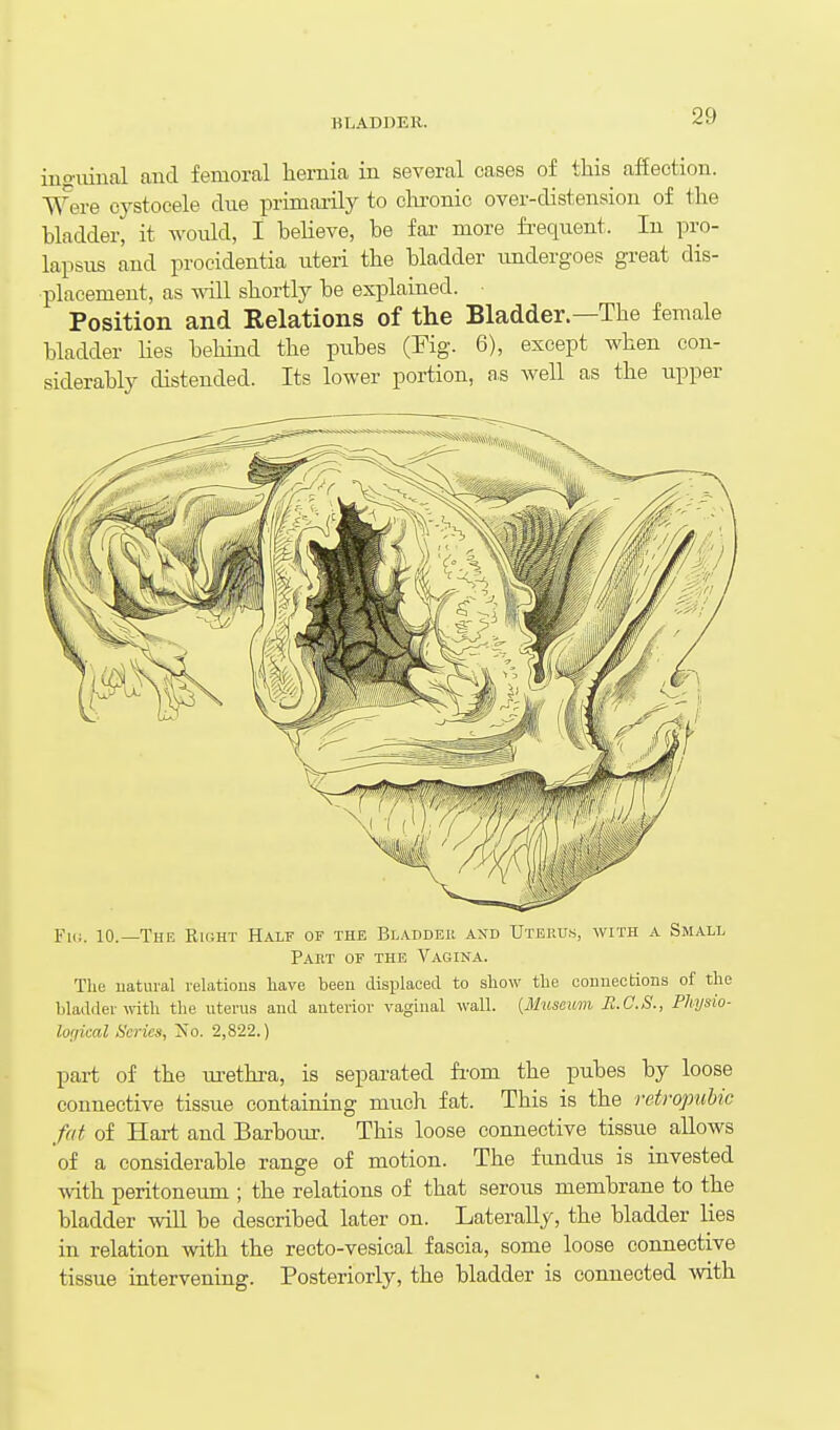 ino-iiiiial and femoral hernia in several cases of this afEection. Were cystocele clue primarily to clu'onic over-distension of the bladder, it would, I believe, be fai- more fi-equent. In pro- lapsus and procidentia uteri the bladder undergoes great dis- placement, as -will shortly be explained. Position and Relations of the Bladder.—The female bladder Kes behind the pubes (Fig. 6), except when con- siderably distended. Its lower portion, as well as the upper Fiii. 10.—The Rkjht Half of the Bladder and Uteuu.s, with a Small Part of the Vagina. The natural relations have been displaced to show the connections of the bladder w-ith the uterus and anterior vaginal wall. [Mxiseimn R.C.S., Physio- loi/ical Scries, Ivo. 2,822.) part of the ui-ethra, is separated fi-om the pubes by loose connective tissue containing much fat. This is the retropubic fat of Hart and Barbour. This loose connective tissue allows of a considerable range of motion. The fundus is invested with peritoneum ; the relations of that serous membrane to the bladder will be described later on. Laterally, the bladder lies in relation with the recto-vesical fascia, some loose connective tissue intervening. Posteriorly, the bladder is connected with