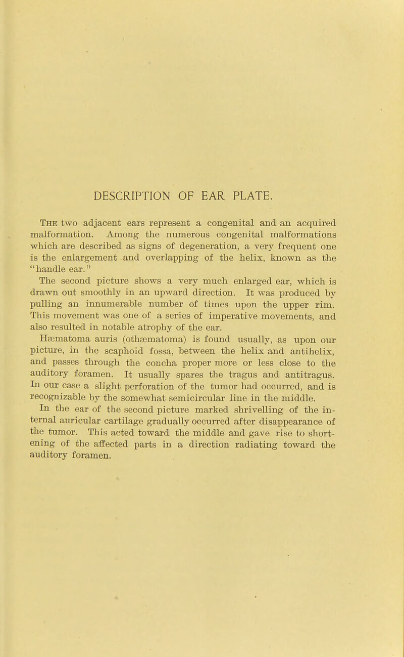 DESCRIPTION OF EAR PLATE. The two adjacent ears represent a congenital and an acquired malformation. Among the numerous congenital malformations which are described as signs of degeneration, a very frequent one is the enlargement and overlapping of the helix, known as the handle ear. The second picture shows a very much enlarged ear, which is drawn out smoothly in an upward direction. It was produced by pulling an innumerable number of times upon the upper rim. This movement was one of a series of imperative movements, and also resulted in notable atrophy of the ear. Hsematoma auris (othsematoraa) is found usually, as upon om- pictm-e, in the scaphoid fossa, between the helix and antihelix, and passes through the concha proper more or less close to the auditory foramen. It usually spares the tragus and antiti-agus. In our case a slight perforation of the tumor had occurred, and is recognizable by the somewhat semicircular line in the middle. In the ear of the second picture marked shrivelling of the in- ternal auricular cartilage gradually occurred after disappearance of the tumor. This acted toward the middle and gave rise to short- ening of the affected parts in a direction radiating toward the auditory foramen.