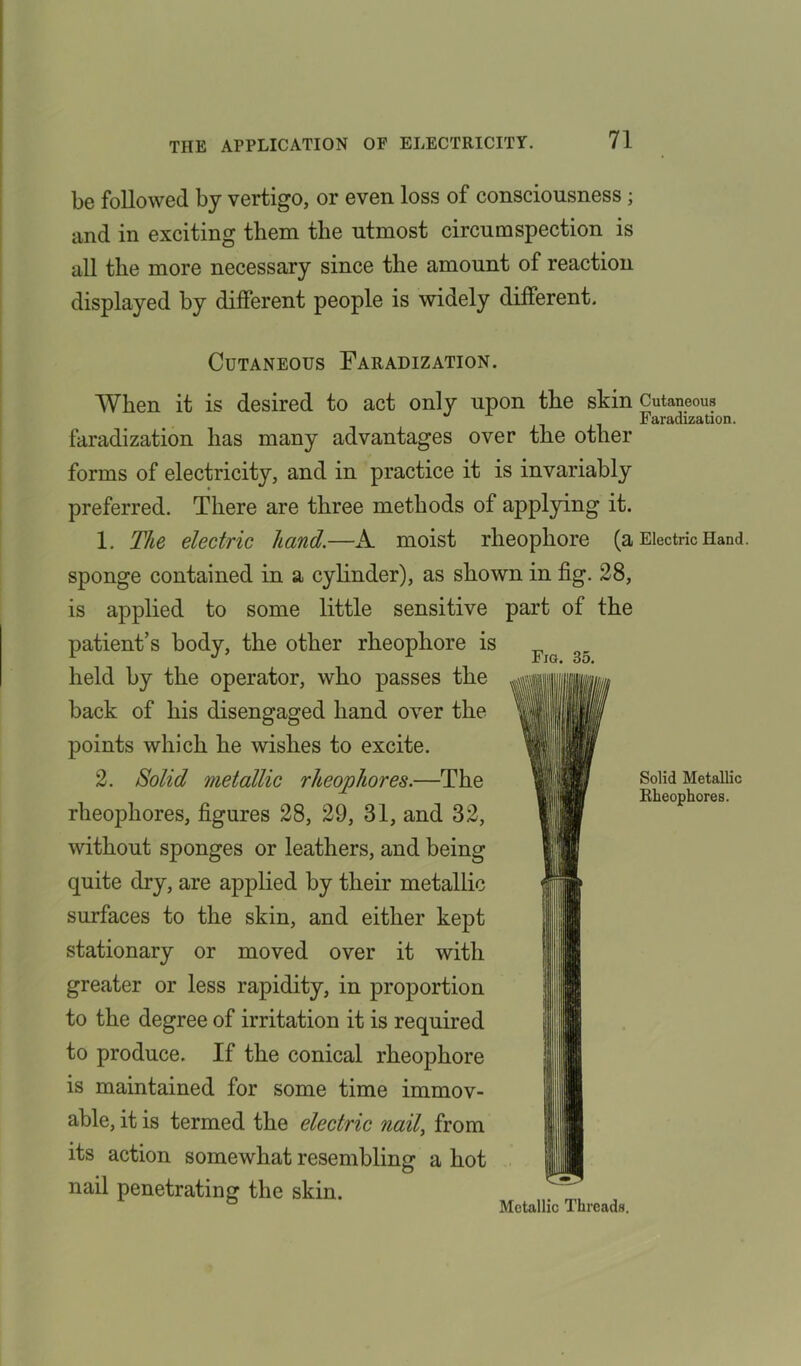 be followed by vertigo, or even loss of consciousness; and in exciting them the utmost circumspection is all the more necessary since the amount of reaction displayed by different people is widely different. Fig. 35. Cutaneous Faradization. When it is desired to act only upon the skin Cutaneous Faradization. faradization has many advantages over the other forms of electricity, and in practice it is invariably preferred. There are three methods of applying it. 1. The electric hand.—A moist rlieopliore (a Electric Hand sponge contained in a cylinder), as shown in fig. 28, is applied to some little sensitive part of the patient’s body, the other rheophore is held by the operator, who passes the back of his disengaged hand over the points which he wishes to excite. 2. Solid metallic rheophores.—The rheophores, figures 28, 29, 31, and 32, without sponges or leathers, and being quite dry, are applied by their metallic surfaces to the skin, and either kept stationary or moved over it with greater or less rapidity, in proportion to the degree of irritation it is required to produce. If the conical rheophore is maintained for some time immov- able, it is termed the electric nail, from its action somewhat resembling a hot nail penetrating the skin. b Metallic Threads. Solid Metallic Rheophores.