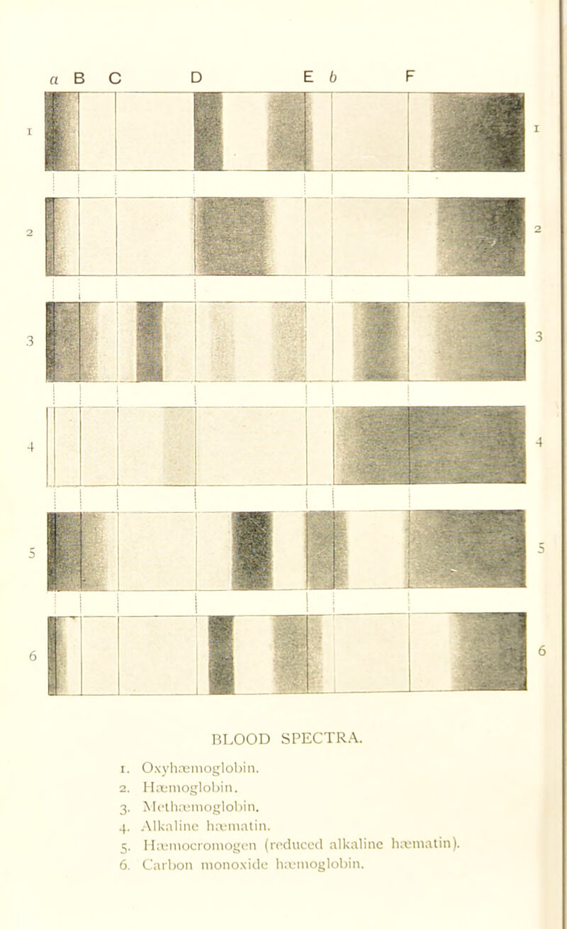 BLOOD SPECTRA. 1. Oxyh.'emoglobin. 2. Htfinoglobin. 3. Mi‘lli,T:!niog1obin. 4. .■Mkalinc ha;matin. 5. Hx'mocromogan (iTchiced alkaline hreniatin). 6. Carbon monoxide luvmoglobin.