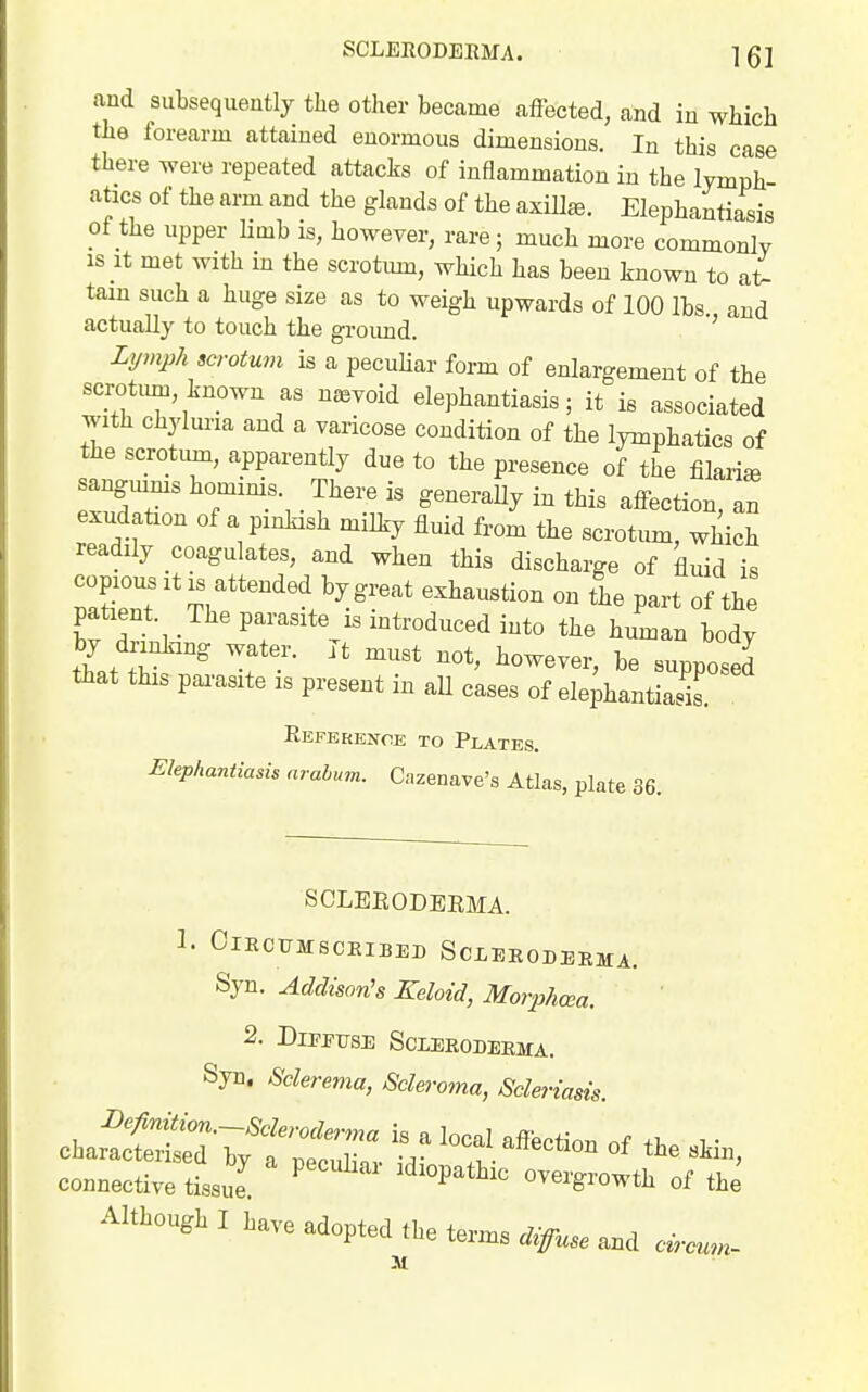 and subsequently the other became affected, and iu which the forearm attained enormous dimensions. In this case there were repeated attacks of inflammation in the lymph- atics of the arm and the glands of the axillee. Elephantiasis of the upper Kmb is, however, rare; much more commonly IS It met with in the scrotmn, which has been known to at- tam such a huge size as to weigh upwards of 100 lbs. and actually to touch the ground. ' Lymph scrotum is a pecuHar form of enlargement of the scrotum, known as nevoid elephantiasis; it is associated with chyluria and a varicose condition of the lymphatics of the scrotum, apparently due to the presence of the fi W sangmms hominis. There is generaUy in this affection, an exudation of a pinkish milky fluid from the scrotum, which readily coagulates, and when this discharge of fluid is copousitis attended by great exhaustion on the part of the patient. The parasite IS introduced into the human body by dnnk-mg water. It must not, however, be supposed that this parasite is present in all cases of elephantiasis. Referenoe to Plates. Elephantiasis nrahum. Cazenave's Atlas, plate 36. SCLEEODEEMA. 1. ClECUMSCEIBED ScXEEODEEMA. Syn. Addison's Keloid, MorphtBa. 2. DlPPTJSI! SCLEEODEEMA. Syn. Sclerema, 8cle>-oma, Scleriasis. connective tissue. ^ »™8'owth of the Althougl I lave adopted the ter™ iig-^^e and o™,,.- M