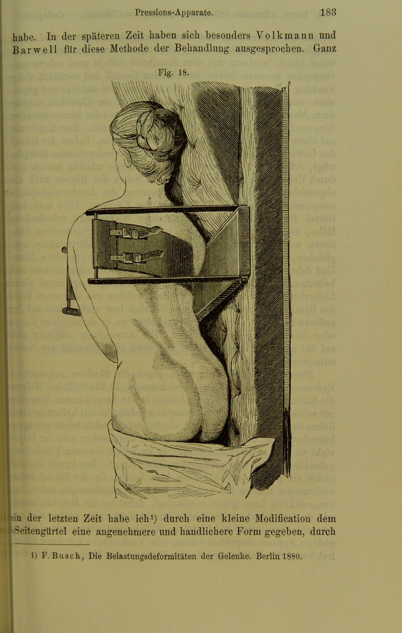 habe. In der späteren Zeit haben sich besonders Volkmann und Bar well für diese Methode der Behandlung ausgesprochen. Ganz Fig. 18. in der letzten Zeit habe ich1) durch eine kleine Modification dem ^eitengürtel eine angenehmere und handlichere Form gegeben, durch 1) F.Busch, Die Belastungsdeformitäten der Gelenke. Berlin 1880.