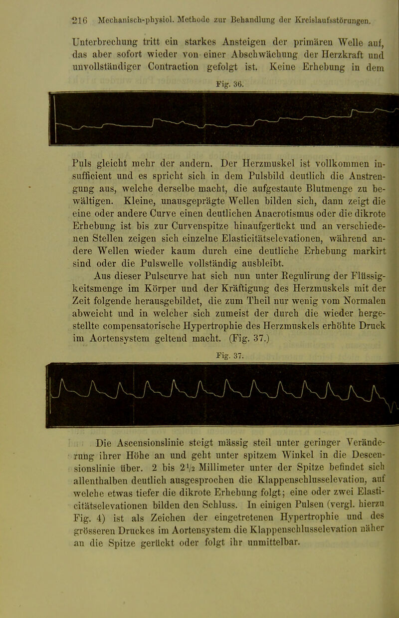 Unterbrechung tritt ein starkes Ansteigen der primären Welle auf, das aber sofort wieder von einer Abschwächung der Herzkraft und unvollständiger Contraction gefolgt ist. Keine Erhebung in dem Fig. 36. Puls gleicht mehr der andern. Der Herzmuskel ist vollkommen in- sufficient und es spricht sich in dem Pulsbild deutlich die Anstren- gung aus, welche derselbe macht, die aufgestaute Blutmenge zu be- wältigen. Kleine, unausgeprägte Wellen bilden sich, dann zeigt die eine oder andere Curve einen deutlichen Anacrotismus oder die dikrote Erhebung ist bis zur Curvenspitze hinaufgertickt und an verschiede- nen Stellen zeigen sich einzelne Elasticitätselevationen, während an- dere Wellen wieder kaum durch eine deutliche Erhebung markirt sind oder die Pulswelle vollständig ausbleibt. Aus dieser Pulscurve hat sich nun unter Regulirung der Flüssig- keitsmenge im Körper und der Kräftigung des Herzmuskels mit der Zeit folgende herausgebildet, die zum Theil nur wenig vom Normalen abweicht und in welcher sich zumeist der durch die wieder herge- stellte compensatorische Hypertrophie des Herzmuskels erhöhte Druck im Aortensystem geltend macht. (Fig. 37.) Fig. 37. Die Ascensionslinie steigt mässig steil unter geringer Verände- rung ihrer Höhe an und geht unter spitzem Winkel in die Descen- sionslinie über. 2 bis 2V2 Millimeter unter der Spitze befindet sich allenthalben deutlich ausgesprochen die Klappenschlusselevation, auf welche etwas tiefer die dikrote Erhebung folgt; eine oder zwei Elasti- citätselevationen bilden den Schluss. In einigen Pulsen (vergl. hierzu Fig. 4) ist als Zeichen der eingetretenen Hypertrophie und des grösseren Druckes im Aortensystem die Klappenschlusselevation näher an die Spitze gerückt oder folgt ihr unmittelbar.