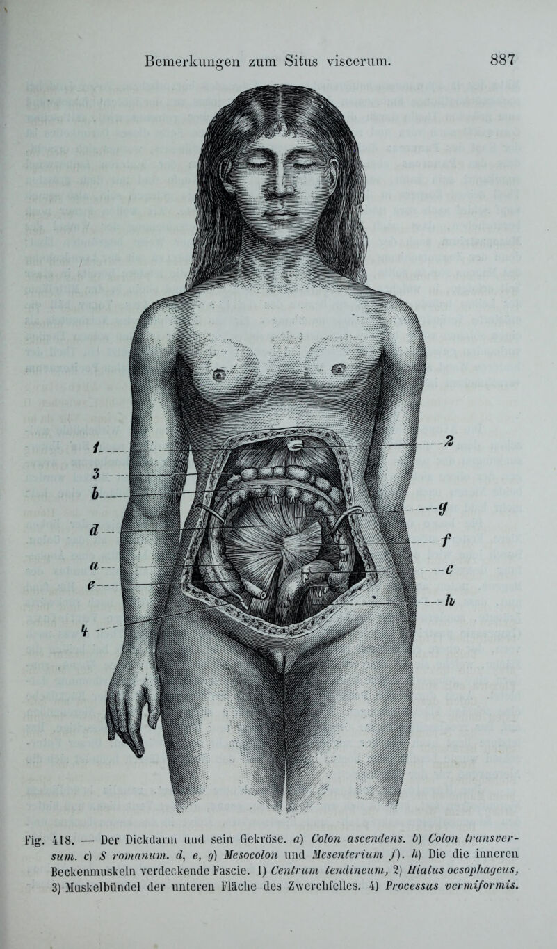 Fi^^ 418. — Der Dickdurm und sein Gekröse, a) Colon ascendens. b) Colon transver- siim. c) S romanum. rf, e, g) Mesocolon und Mesentenum /). h) Die die inneren Beckenmuskeln verdeckende Fascie. 1) Centrum tendineum, 2) Hiatus oesophageus, 3) Muskelbündel der unteren Fläche des Z^Yercllfellcs. 4) Processus vermiformis.