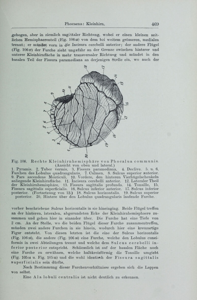 ^gebogen, aber in ziemlich sagittaier Eichtling, wobei er einen kleinen seit- lichen Hemisphaerenteil (Fig. 10612) von dem bei weitem grösseren, medialen trennt; er mündet vorn in die Incisura cerebelli anterior; der andere Flügel (Fig. 10617) der Furche zieht ungefähr an der Grenze zwischen hinterer und unterer Kleinhirnfläche in mehr transversaler Eichtung und mündet in den basalen Teil der Fissura paramediana an derjenigen Stelle ein, wo auch der Fig. 106, E e c h t e K1 e i n h i r n h e m i s p h ä re v o n P h o c a 1 u a c o m m u n i s. (Ansicht von oben und lateral.) 1. Pyramis. 2. Tuber vermis. 3. Fissura paramediana. 4. Declive. 5. u. 6. Furchen des Lobulus quadrangularis. 7. Culmen. 8. Sillens superior anterior. 9. Pars ascendens Monticuli. 10. Vordere, den hinteren Vierhügelschenkeln anliegende Kleinhirnfläche. 11. Incisura cerebelli anterior. 12. Lateraler Theil der Kleinhirnhemisphäre. 13. Fissura sagittalis profunda. 14. Tonsille. 15. Fissura sagittalis superficialis. 16. Sulcus inferior anterior. 17. Sulcus inferior posterior. (Fortsetzung von 13.) 18. Sulcus horizontalis. 19. Sulcus superior posterior. 20. Hintere über den Lobulus quadrangularis laufende Furche. vorher beschriebene Sulcus horizontalis in sie hineinging. Beide Flügel treffen an der hinteren, lateralen, abgerundeten Ecke der Kleinhirnhemisphaere zu- sammen und gehen hier in einander über. Die Furche hat eine Tiefe von 2 cm. An der Stelle, wo die beiden Flügel dieser Furche zusammentreffen, münden zwei andere Furchen in sie hinein, wodurch hier eine kreuzartige Figur entsteht. Von diesen letzten ist die eine der Sulcus horizontalis (Fig. 10618), die andere (Fig. 10616) eine Furche, welche den Lobulus cunei- formis in zwei Abteilungen trennt und welche dem Sulcus cerebelli in- ferior posterior entspricht. Schliesslich ist auf der basalen Fläche noch eine Furche zu erwähnen, welche halbkreisförmig die Tonsille umgiebt (Fig. 10514 u. Fig. 10515) und die wohl identistih der Fissura sagittalis superficialis sein dürfte. Nach Bestimmung dieser Furchenverhältnisse ergeben sich die Lappen von selbst. Eine Ala lobuli centralis ist nicht deutlich zu erkennen.