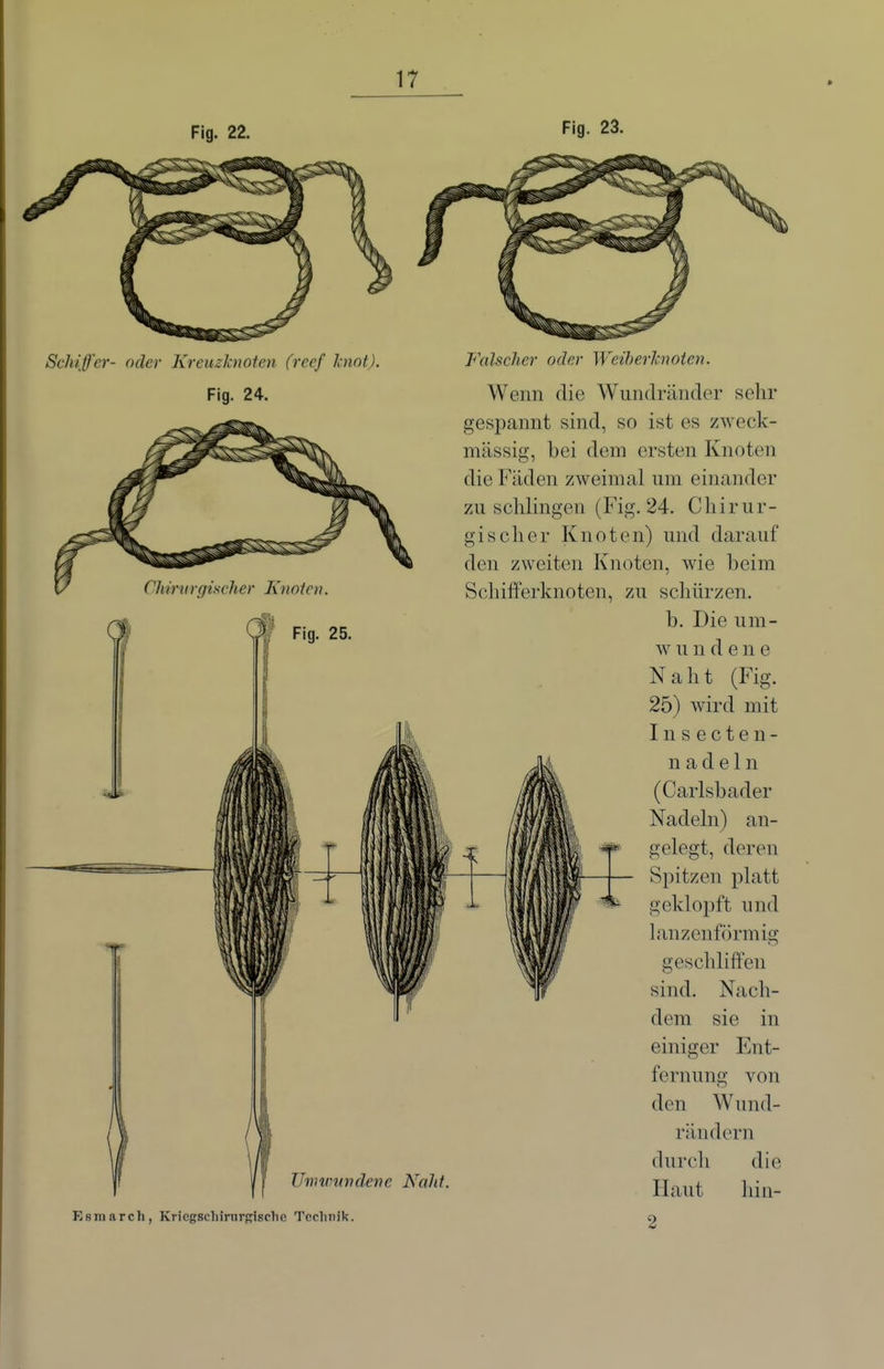 Fig. 22. Fig. 23. Schiffer- oder Kreuzknoten (rcef hiot). Fig. 24. Chvntrgischer Knoten. Fig. 25. Ihmimvdene Naht. Esmarch, KricgscliiriirRisclio Technik. Falscher oder Weiherhnoten. Wenn die Wundränder selir gespannt sind, so ist es zweck- mässig, bei dem ersten Knoten die Fäden zweimal um einander zu schlingen (Fig. 24. Chirur- gischer Knoten) und darauf den zweiten Knoten, wie beim Schifferknoten, zu schürzen. b. Die um- w u n d e n e Naht (Fig. 25) wird mit Insecten- nadeln (Carlsbader Nadeln) an- gelegt, deren Spitzen platt geklopft und lanzenförmig geschliffen sind. Nach- dem sie in einiger Ent- fernung von den Wund- rändern durcli die Haut hin- 2