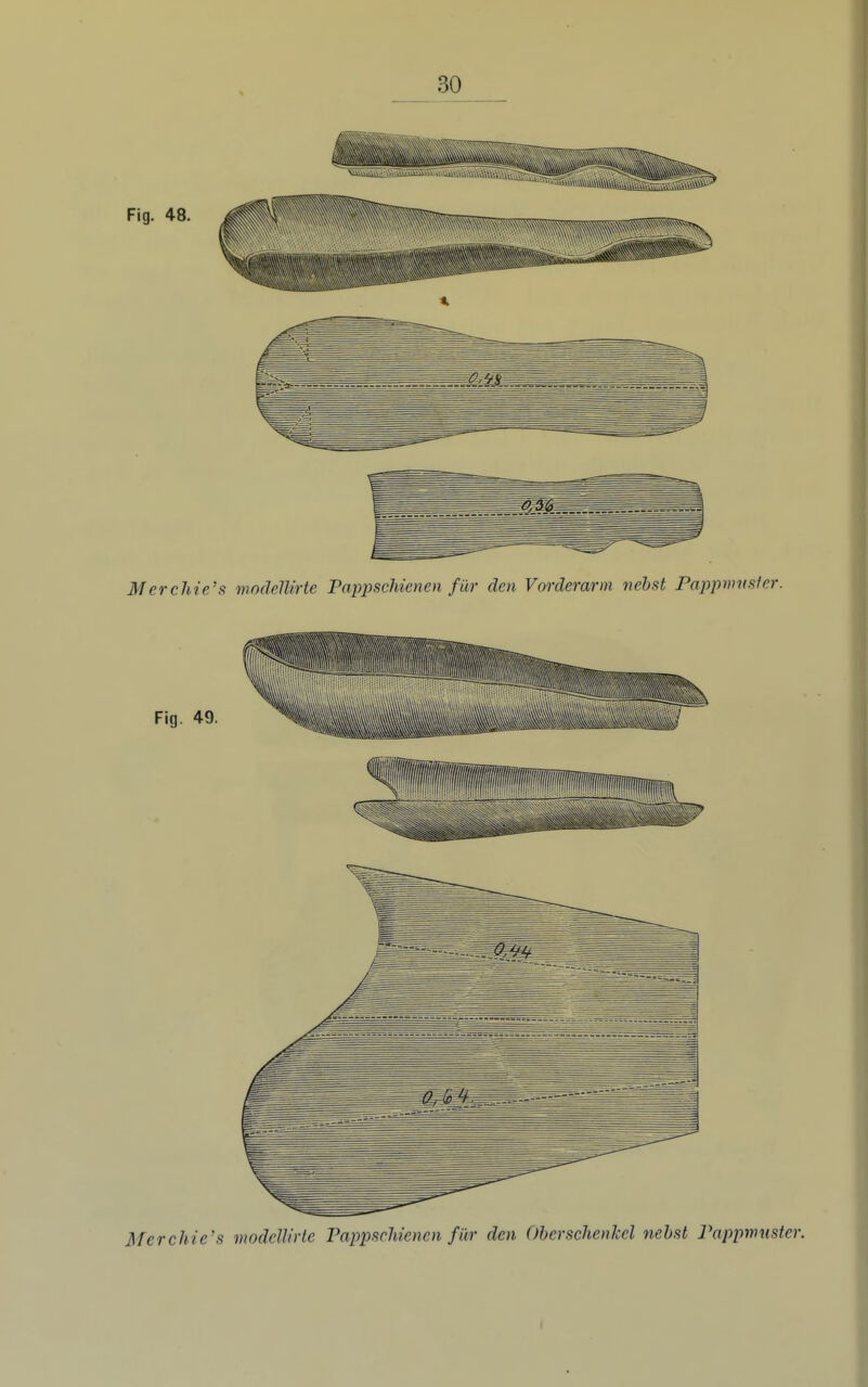 Fig. 48. Merchie's mndeUirte PappscMenen für den Vorderarm liebst Pappmusfcr. Fig. 49. Merchie's modcllirlc Pappschienen für den OherschenM nebst Pappwuster. I