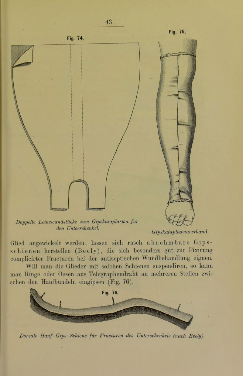 Fig. 75. Fig. 74. Doppelte Leine wandstücke zum Gipslcataplasma für den Unterschenkel. ^. , , , , Gipskataplasmaverbana. Glied augewiekelt werden, lassen sich rascli abnehmbare Gips- schienen herstellen (Beely), die sich besonders gnt zur Fixirung complicirter Fracturen bei der antiseptischen Wundbehandlung eignen. Will man die Glieder mit solchen Schienen suspendiren, so kann man Ringe oder Oesen aus Telegraphendraht an mehreren Stellen zwi- schen den Hanfbündeln eingipsen (Fig. 76). ^ Fig. 76. Dorsale Hanf-Gips-Schiene für Fracturen des Unterschenkels (nach Beely).