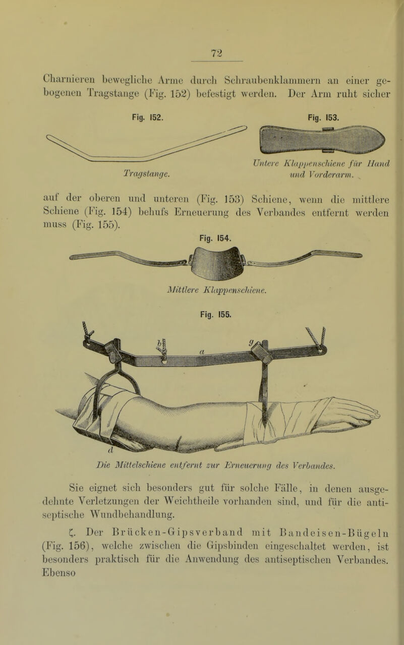 Charniereii bewegliche Arme diircli Scliraiibenklanimerii an einer ge- bogenen Tragstange (Fig. 152) befestigt werden. Der Arm ruht sicher Fig. 152. Fig. 153. Tragstange. und Vorderarm. auf der oberen und unteren (Fig. 153) Schiene, wemi die mittlere Schiene (Fig. 154) behufs Erneuerung des Verbandes entfernt werden muss (Fig. 155). Fig. 154. Mit tlere KU ipf) cnsch io i e. Fig. 155. Die Mittelschiene entfernt sur Erneuerung des Verbandes. Sie eignet sich besonders gut für solche Fälle, in denen ausge- dehnte Verletzungen der Weichtheile vorhanden sind, und für die anti- septische Wundbehandlung. C. Der Brücken-Gipsverband mit Bandeisen-Bügeln (Fig. 156), welche zwischen die Gipsbinden eingeschaltet Averden, ist besonders praktisch für die Anwendung des antiseptischen Verbandes. Ebenso