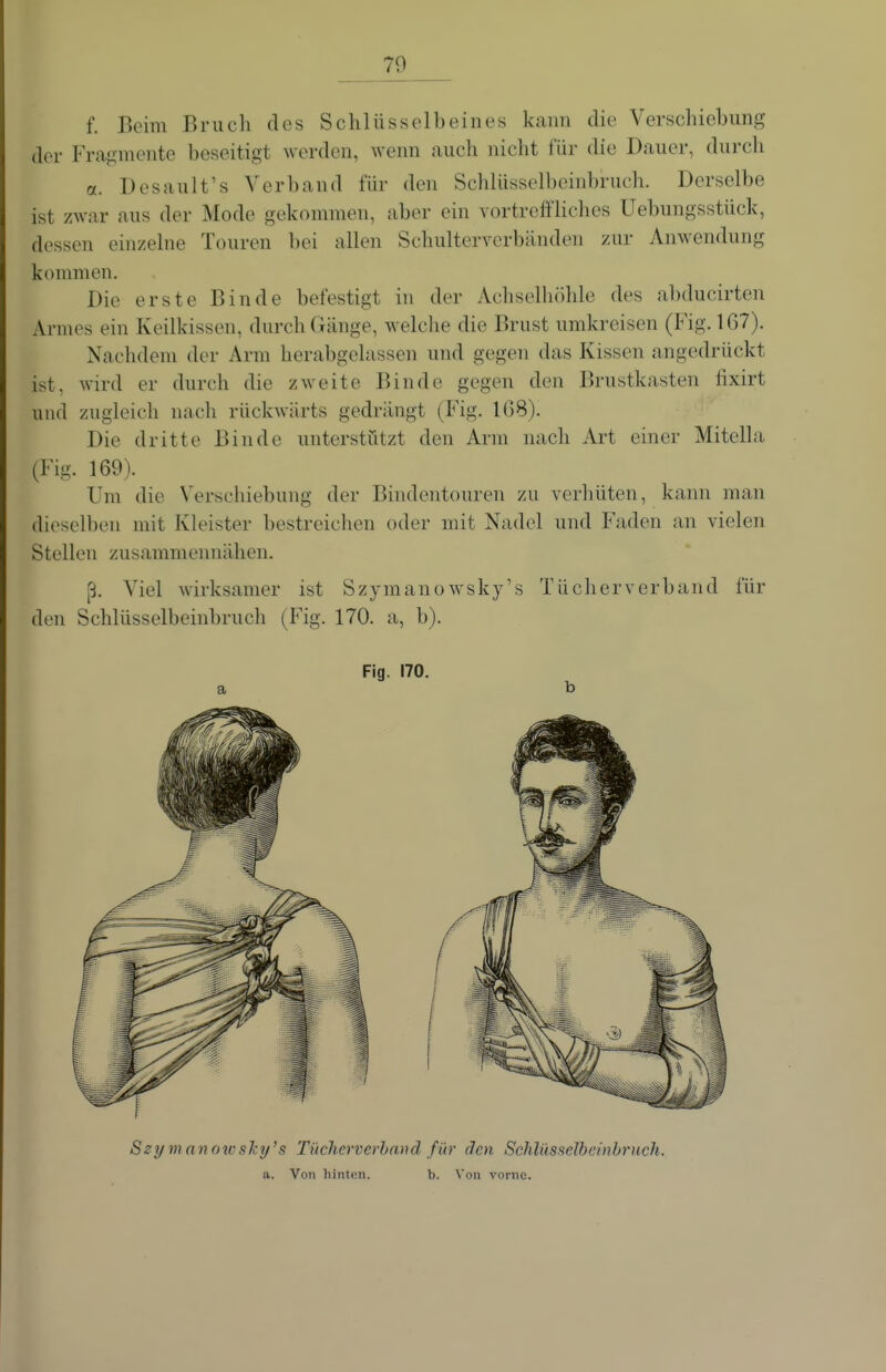 f. Beim Bruch des Schlüsselbeines kann die Verschiebung der Frajiinente beseitigt werden, Avenn auch nicht für die Dauer, durch a. Desault's Verband für den Schlüsselbeinbruch. Derselbe ist zwar aus der Mode gekommen, aber ein vortreffliches Uebungsstück, dessen einzelne Touren bei allen Schulterverbänden zur Anwendung kommen. Die erste Binde befestigt in der Achselhöhle des al)ducirten Armes ein Keilkissen, durch Gänge, welche die Brust umkreisen (Fig. 1G7). Nachdem der Arm herabgelassen und gegen das Kissen angedrückt ist, wird er durch die zweite Binde gegen den Brustkasten fixirt und zugleich nach rückwärts gedrängt (Fig. 1G8). Die dritte Binde unterstützt den Arm nach Art einer Mitella (Fig. 169). Um die Verschiebung der Bindentouren zu verhüten, kann man dieselben mit Kleister bestreichen oder mit Nadel und Faden an vielen Stellen zusammennähen. Viel wirksamer ist Szymanowsky's Tücherverband für den Schlüsselbeinbruch (Fig. 170. a, b). Fig. 170. Szymanotvsky^s Tücherverhmid, für clcn Schliisselbeinbruch. a. Von hinten. b. \'oii vorne.