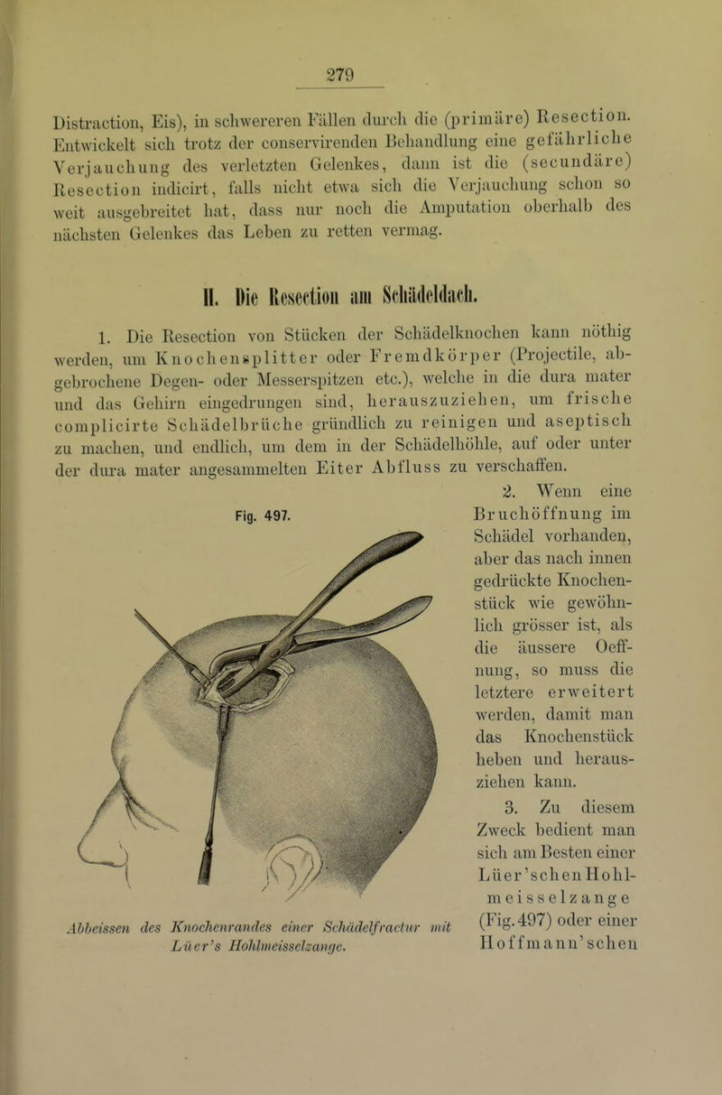 Distraction, Eis), in schwereren Fällen durch die (primäre) Resection. Entwickelt sich trotz der conservirenden Behandlung eine gefährliche Verjauchung des verletzten Gelenkes, dann ist die (secundäre) Resection indicirt, falls nicht etwa sich die Verjauchung schon so weit ausgehreitet hat, dass nur noch die Amputation oberhalb des nächsten Gelenkes das Leben zu retten vermag. 11. Die ReHcetioii am Scliädeldacli. 1. Die Resection von Stücken der Schädelknochen kann nötliig werden, um Knochensplitter oder Fremdkörper (Projectile, ab- gebrochene Degen- oder Messerspitzen etc.), welche in die dura mater und das Gehirn eingedrungen sind, herauszuziehen, um frische complicirte Schädelbrüche gründlich zu reinigen und aseptisch zu machen, und endlich, um dem in der Schädelhöhle, auf oder unter der dura mater angesammelten Eiter Abfluss zu verschaffen. 2. Wenn eine Fig. 497. Bruchöffnung im Schädel vorhanden, aber das nach innen gedrückte Knochen- stück wie gewöhn- lich grösser ist, als die äussere Oeff- nung, so muss die letztere erweitert Averden, damit man das Knochenstück heben und heraus- ziehen kann. 3. Zu diesem Zweck bedient man sich am Besten einer Lüer'schen Hohl- meisselzange Äbbeissen des Knochenrandes einer ScMdelfradur mit (Fig. 497) odei einer Lüer's Hohlnieissehangc. H 0 f fm ann' scheu