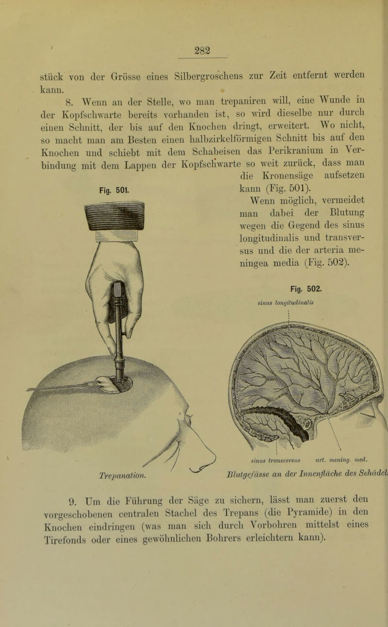 stück von der Grösse eines Silbergroscliens zur Zeit entfernt werden kann. 8. Wenn an der Stelle, wo man trepaniren will, eine Wunde in der Kopfscliwarte bereits vorhanden ist, so wird dieselbe nur durcli einen Schnitt, der bis auf den Knochen dringt, erweitert. Wo nicht, so macht man am Besten einen halbzirkelförmigen Schnitt bis auf den Knochen und schiebt mit dem Schabeisen das Perikranium in Ver- bindung mit dem Lappen der Kopfscliwarte so weit zurück, dass man die Kronensäge Fig. 501. aufsetzen kann (Fig. 501). Wenn möglich, vermeidet man dabei der Blutung wegen die Gegend des sinus longitudinalis und transver- sus und die der arteria me- ningea media (Fig. 502). Fig. 502. sinus longitudinalis Trepanation sinus transversus art. mening. med. Blutgefässe an der Innenfläche des Sehädel 9. Um die Führung der Säge zu sichern, lässt man zuerst den vorgeschobenen centralen Stachel des Trepans (die Pyramide) in den Knochen eindringen (Avas man sich durch Vorbohren mittelst eines Tirefonds oder eines gewöhnlichen Bohrers erleichtern kann).
