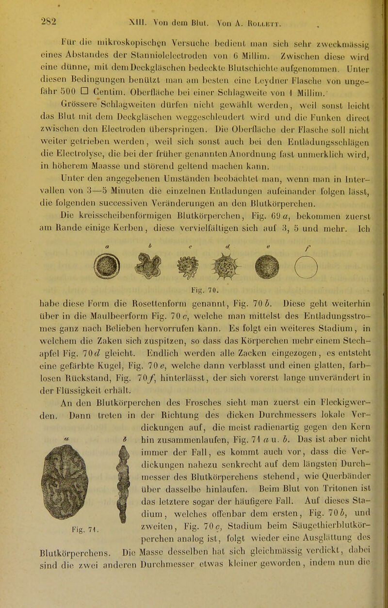 Für die niikioskopischcn Versucho bediciil mau sich sehr zweckniiissis eines Abstaudes der Stauniolcleclrodeii von C Millim. Zwischen diese wird eine dünne, niil dem Deckgläschen bedeckte Blulschichle aufgenommen. Unter diesen Bedingungen benülzl man am besten eine Leydner Flasche von unge- fähr 500 □ Cenlim. Oberfläche bei einer Schlagweile von i Millim. Grössere Schlagweilen dürfen nicht gewählt werden, weil sonst leicht das Blut mit dem Deckgläschen weggeschleuderl wird und die Funken diiecl zwischen den Electroden überspringen. Die Oberfläche der Flasche soll nicht weiter getrieben werden, weil sich sonst auch bei den Entlädungsschlägen die Eleclrolyse, die bei der früher genannten Anordnung fast unmerklich wird, in höherem Maasse und störend geltend machen kann. Unter den angegebenen Uniständen beobachtet man, wenn man in Inter- vallen von 3—5 Minuten die einzelnen Entladungen aufeinander folgen lässl, die folgenden successiven Veränderungen an den Blutkörperchen. Die kreisscheibenförmigen Blutkörperchen, Fig. 69 cz, bekommen zuerst am Rande einige Kerben, diese vervielfältigen sich auf 3, 5 und mehr. Ich a /> c dl e Fig. 70. habe diese Form die Rosellenform genannt, Fig. 70 ^i. Diese gehl weiterhin über in die Maulbeerform Fig. 70 c, welche man mittelst des Entladungsstro- mes ganz nach Belieben hervorrufen kann. Es folgt ein weiteres Stadium, in welchem die Zaken sich zuspitzen, so dass das Körperchen raehr einem Stech- apfel Fig. 70f/ gleicht. Endlich werden alle Zacken eingezogen, es entsteht eine gefärbte Kugel, Fig. 70 e, welche dann verblasst und einen glatten, farb- losen Rückstand, Fig. 70/, hinlerlässt, der sich vorerst lange unverändert in der Flüssigkeit erhält. An den Blutkörperchen des Frosches sieht man zuerst ein Fleckigwer- den. Dann treten in der Richtung des dicken Durchmessers lokale Ver- dickungen auf, die meist radienarlig gegen den Kern « * hin zusammenlaufen, Fig. 71 au. b. Das ist aber nicht immer der Fall, es kommt auch vor, dass die Ver- dickungen nahezu senkrecht auf dem längsten Durch- messer des Blutkörperchens stehend, wie Querbänder über dasselbe hinlaufen. Beim Blut von Tritonen ist das letztere sogar der häufigere Fall. Auf dieses Sta- dium , welches oflenbar dem ersten, Fig. 10b, und zweiten, Fig. 70c, Stadium beim Säugcthierblulkör- perchen analog ist, folgt wieder eine Ausglätlung des Blutkörperchens. Die Masse desselben hat sich gicichnüissig verdickt, dabei sind die zwei anderen Durchmesser etwas kleiner geworden, indem nun die