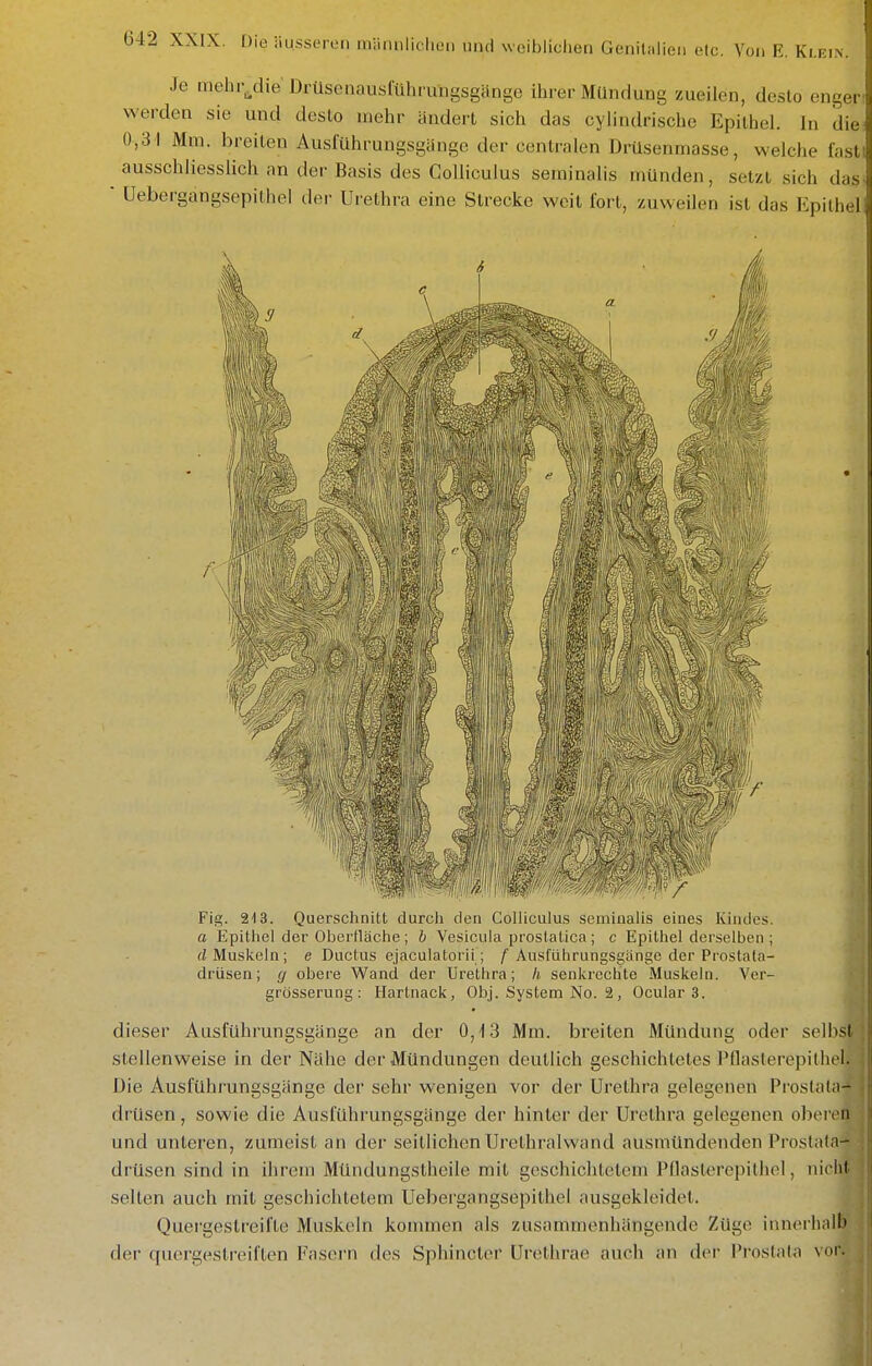 Je mehr^die'Drüsenausfühiungsgänge ihrer Mündung zueilen, desto enger! werden sie und desto mehr ändert sich das cylindrische Epithel. In die 0,31 Mm. breiten Ausfuhrungsgänge der centralen Drüsenmasse, welche fasti ausschliesslich an der Basis des Colliculus seminalis münden, setzt sich das. üebergangsepithei dei- Urethra eine Strecke weit fort, zuweilen ist das Epithel Fig. Querschnitt durch den Colliculus seminalis eines Kindes, a Epithel der Oberfläche; h Vesicuia prostatica; c Epithel derselben ; d Muskeln; e Ductus ejaculatoiii; /■ Ausftihrungsgange der Prostafa- drüsen; g obere Wand der Urethra; h senkrechte Muskeln. Ver- grösserung: Hartnack, Obj. System No. 2, Ocular 3. dieser Ausführungsgänge an der 0,13 Mm. breiten Mündung oder selbst stellenweise in der Nähe der Mündungen deutlich geschichtetes Pflasterepithel. Die Ausführungsgänge der sehr wenigen vor der Urethra gelegenen Prostata-* drüsen, sowie die Ausiührungsgänge der hinter der Urethra gelegenen oberen und unteren, zumeist an der seitlichen Urethralwand ausmündenden Prostata- drüsen sind in ihrem Mündungsthcile mit geschichtetem Pflasterepithel, nicht selten auch mit geschichtetem Üebergangsepithei ausgekleidet. Quei'gestreifle Muskeln kommen als zusammenhängende Züge innei'halb der quergestreiften Fasern des Sphincter ürethrae auch an der Prostata voi.