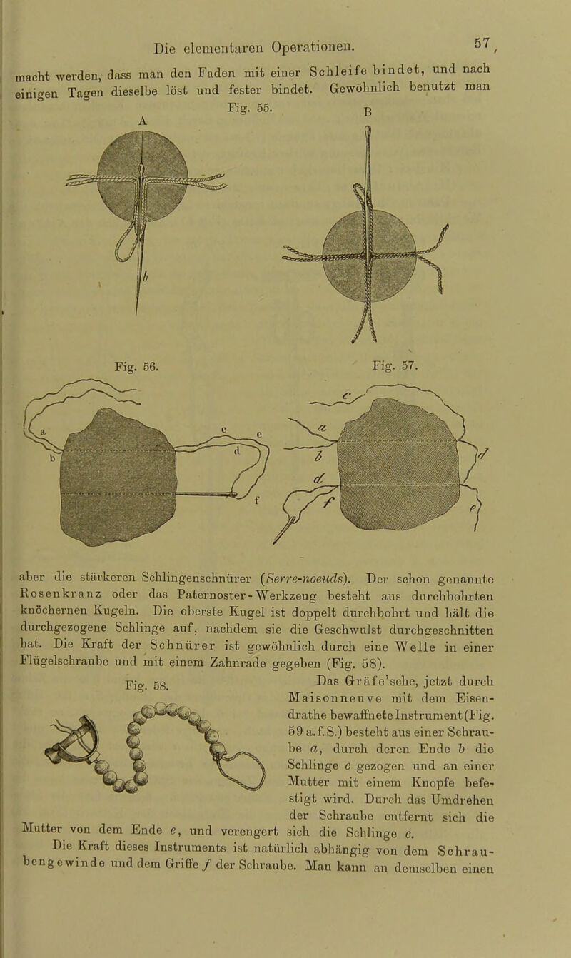 macht werden, dass man den Faden mit einer Schleife bindet, und nach einigen Tagen dieselbe löst und fester bindet. Gewöhnlich benutzt man Fig. 55. Fig. 56. Fig. 57. aber die stärkeren Schlingenschnürer (Serre-noeuds). Der schon genannte Rosenkranz oder das Paternoster - Werkzeug besteht aus durchbohrten knöchernen Kugeln. Die oberste Kugel ist doppelt durchbohrt und hält die durchgezogene Schlinge auf, nachdem sie die Geschwulst durchgeschnitten hat. Die Kraft der Schnür er ist gewöhnlich durch eine Welle in einer riügelschraube und mit einem Zahnrade gegeben (Fig. 58). 5g Das Gräfe'sche, jetzt durch Maisonneuve mit dem Eisen- drathe bewaffnete Instrument (Fig. 59 a.f.S.) besteht aus einer Schrau.- be a, durch deren Ende b die Schlinge c gezogen und an einer Mutter mit einem Knopfe befe- stigt wird. Duj-ch das Umdrehen der Schraube entfernt sich die Mutter von dem Ende e, und verengert sich die Schlinge c. Die Kraft dieses Instruments ist natürlich abhängig von dem Schrau- bengewinde und dem Griffe / der Schraube. Man kann an demselben einen