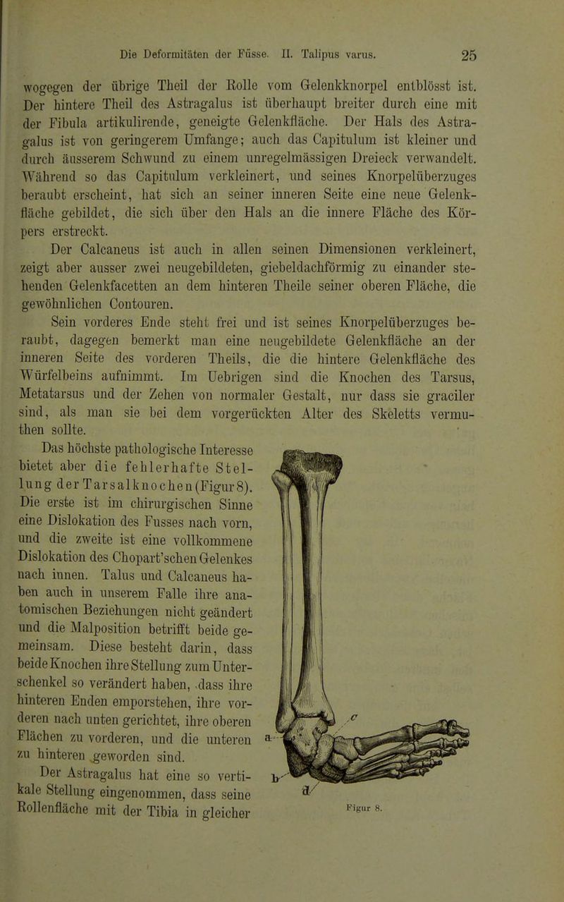 wogegen der übrige Theil der Kolle vom Gelenkknorpel enlblösst ist. Der hintere Theil des Astragalus ist überhaupt breiter durch eine mit der Fibula artikulirende, geneigte Gelenkfläche. Der Hals des Astra- galus ist von geringerem Umfange; auch das Capitulum ist kleiner und durch äusserem Schwund zu einem unregelmässigen Dreieck venvandelt. Während so das Capitulum verkleinert, und seines Knorpelüberzuges beraubt erscheint, hat sich an seiner inneren Seite eine neue Gelenk- fläche gebildet, die sich über den Hals an die innere Fläche des Kör- pers erstreckt. Der Calcaneus ist auch in allen seinen Dimensionen verkleinert, zeigt aber ausser zwei neugebildeten, giebeldachförmig zu einander ste- henden Gelenkfacetten an dem hinteren Theile seiner oberen Fläche, die gewöhnlichen Contouren. Sein vorderes Ende steht frei und ist seines Knorpelüberzuges be- raubt, dagegen bemerkt man eine neugebildete Gelenkfläche an der inneren Seite des vorderen Theils, die die hintere Gelenkfläche des Würfelbeins aufnimmt. Im üebrigen sind die Knochen des Tarsus, Metatarsus und der Zehen von normaler Gestalt, nur dass sie gradier sind, als man sie bei dem vorgerückten Alter des Skeletts vermu- then sollte. Das höchste pathologische Interesse bietet aber die fehlerhafte Stel- lung der Tarsalknochen(Figur8). Die erste ist im chirurgischen Sinne eine Dislokation des Fusses nach vorn, und die zweite ist eine vollkommene Dislokation des Chopart'schen Gelenkes nach innen. Talus und Calcaneus ha- ben auch in unserem Falle ihre ana- tomischen Beziehungen nicht geändert und die Malposition betrifft beide ge- meinsam. Diese besteht darin, dass beide Knochen ihre Stellung zum Unter- schenkel so verändert haben, <dass ihre hinteren Enden emporstehen, ihre vor- deren nach unten gerichtet, ihre oberen Flächen zu vorderen, und die unteren zu hinteren .geworden sind. Der Astragalus hat eine so verti- kale Stellung eingenommen, dass seine Rollenfläche mit der Tibia in gleicher Figur 8.