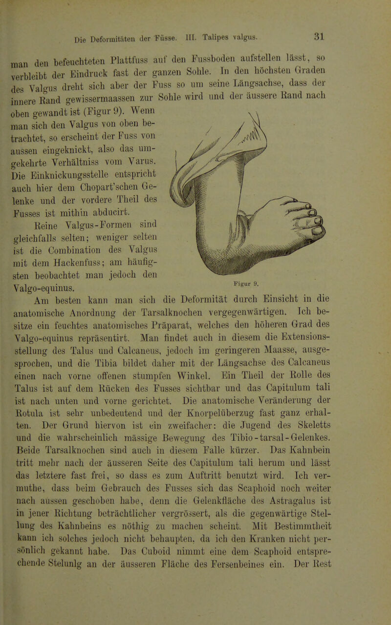 Figur 9. man den befeuchteten Plattfuss auf den Pussboden aufstellen lässt, so verbleibt der Eindruck fast der ganzen Sohle. In den höchsten Graden des Vatois dreht sich aber der Fuss so um seine Längsachse, dass der innere Band gewissermaassen zur Sohle wird und der äussere Rand nach oben gewandt ist (Figur 9). Wenn man sich den Valgus von oben be- trachtet, so erscheint der Fuss von aussen eingeknickt, also das um- gekehrte Verhältniss vom Varus. Die Einknickungsstelle entspricht auch hier dem Chopart'schen Ge- lenke und der vordere Tb eil des Fusses ist mithin abducirt. Reine Valgus-Formen sind gleichfalls selten; weniger selten ist die Combination des Valgus mit dem Hackenfuss; am häufig- sten beobachtet man jedoch den Valgo-equinus. Am besten kann man sich die Deformität durch Einsicht in die anatomische Anordnung der Tarsalknochen vergegenwärtigen. Ich be- sitze ein feuchtes anatomisches Präparat, welches den höheren Grad des Valgo-equinus repräsentirt. Man findet auch in diesem die Extensions- stellung des Talus und Calcaneus, jedoch im geringeren Maasse, ausge- sprochen, und die Tibia bildet daher mit der Längsachse des Calcaneus einen nach vorne offenen stumpfen Winkel. Ein Theil der Rolle des Talus ist auf dem Rücken de3 Fusses sichtbar und das Capitulum tali ist nach unten und vorne gerichtet. Die anatomische Veränderung der Rotüla ist sehr unbedeutend und der Knorpelüberzug fast ganz erhal- ten. Der Grund hiervon ist ein zweifacher: die Jugend des Skeletts und die wahrscheinlich mässige Bewegung des Tibio-tarsal-Gelenkes. Beide Tarsalknochen sind auch in diesem Falle kürzer. Das Kahnbein tritt mehr nach der äusseren Seite des Capitulum tali herum und lässt das letztere fast frei, so dass es zum Auftritt benutzt wird. Ich ver- muthe, dass beim Gebrauch des Fusses sich das Scaphoid noch weiter nach aussen geschoben habe, denn die Gelenkfläche des Astragalus ist in jener Richtung beträchtlicher vergrößert, als die gegenwärtige Stel- lung des Kahnbeins es nöthig zu machen scheint. Mit Bestimmtheit kann ich solches jedoch nicht behaupten, da ich den Kranken nicht per- sönlich gekannt habe. Das Cuboid nimmt eine dem Scaphoid entspre- chende Stelunlg an der äusseren Fläche des Fersenbeines ein. Der Rest