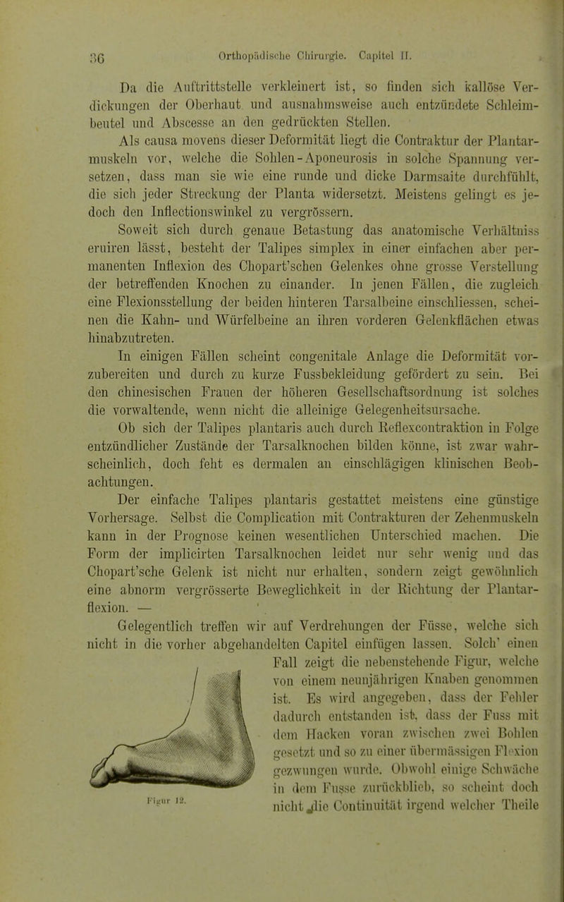 Da die Auftrittstelle verkleinert ist, so finden sich kailöse Ver- dickungen der Oberhaut und ausnahmsweise auch entzündete Schleim- beutel und Abscesse an den gedrückten Stellen. Als causa movens dieser Deformität liegt die Contraktur der Plantar- muskeln vor, welche die Sohlen - Aponeurosis in solche Spannung ver- setzen, dass man sie wie eine runde und dicke Darmsaite durchfühlt, die sich jeder Streckung der Planta widersetzt. Meistens gelingt es je- doch den Inflectionswinkel zu vergrössern. Soweit sich durch genaue Betastung das anatomische Verhältniss eruiren lässt, besteht der Talipes simplex in einer einfachen aber per- manenten Inflexion des Chopart'schen Gelenkes ohne grosse Verstellung der betreffenden Knochen zu einander. In jenen Fällen, die zugleich eine Flexionsstellung der beiden hinteren Tarsalbeine einschliessen, schei- nen die Kahn- und Würfelbeine an ihren vorderen Gelenkflächen etwas hinabzutreten. In einigen Fällen scheint congenitale Anlage die Deformität vor- zubereiten und durch zu kurze Fussbekleidung gefördert zu sein. Bei den chinesischen Frauen der höheren Gesellschaftsordnung ist solches die vorwaltende, wenn nicht die alleinige Gelegenheitsursache. Ob sich der Talipes plantaris auch durch Reflexeontraktion in Folge entzündlicher Zustände der Tarsalknochen bilden könne, ist zwar wahr- scheinlich, doch feht es dermalen an einschlägigen klinischen Beob- achtungen. Der einfache Talipes plantaris gestattet meistens eine günstige Vorhersage. Selbst die Complication mit Contrakturen der Zehenmuskeln kann in der Prognose keinen wesentlichen Unterschied raachen. Die Form der implicirten Tarsalknochen leidet nur sehr wenig und das Chopart'sche Gelenk ist nicht nur erhalten, sondern zeigt gewöhnlich eine abnorm vergrösserte Beweglichkeit in der Richtung der Plantar- floxion. — Gelegentlich treffen wir auf Verdrehungen der Füsse, welche sich nicht in die vorher abgehandelten Capitel einfügen lassen. Solch' einen Fall zeigt die nebenstehende Figur, welche von einem neunjährigen Knaben genommen ist. Es wird angegeben, dass der Fehler dadurch entstanden ist, dass der Fuss mit dem Hacken voran zwischen zwei Bohlen gesetzt und so zu einer übermässigen Flexion gezwungen wurde. Obwohl einige Schwäche in dem Fusse zurückblicb, so scheint doch nicht .flie Continuität irgend welcher Theile
