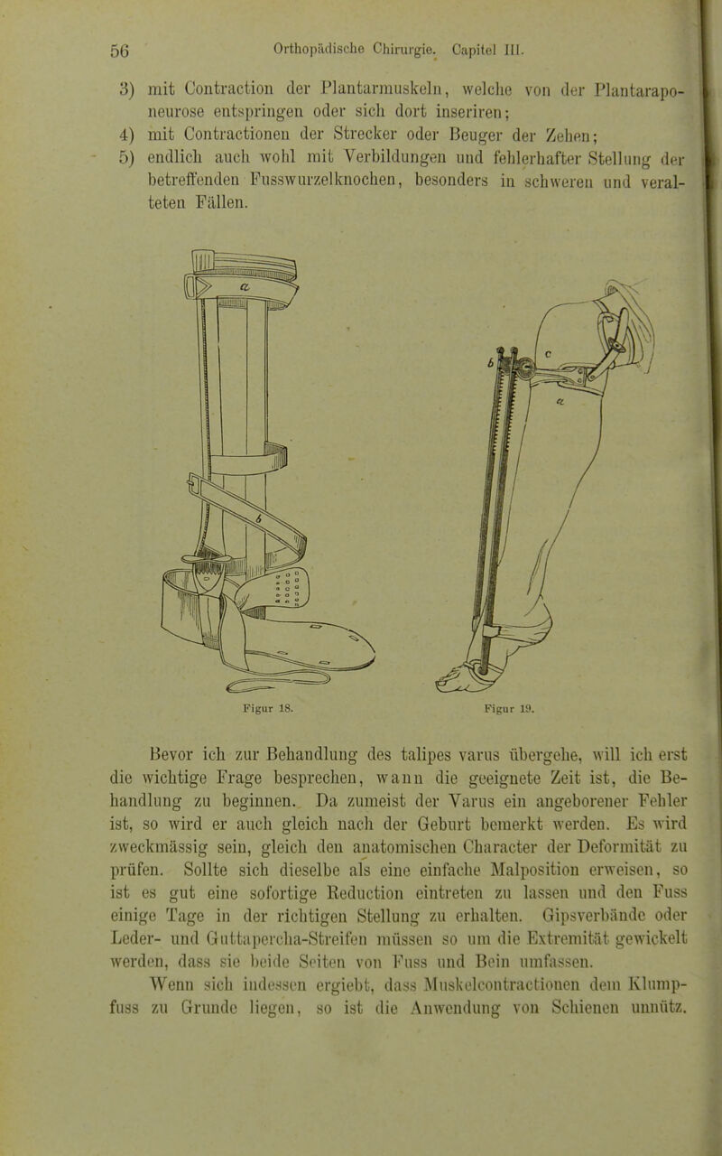 3) mit Contraction der Plantarmuskeln, welche von der Plantarapo- neurose entspringen oder sich dort inseriren; 4) mit Contractionen der Strecker oder Beuger der Zehen; 5) endlich auch wohl mit Verbildungen und fehlerhafter Stellung der betreffenden Pusswurzelknochen, besonders in schweren und veral- teten Fällen. Figur 18. Figur 19. Bevor ich zur Behandlung des talipes varus übergehe, will ich erst die wichtige Frage besprechen, wann die geeignete Zeit ist, die Be- handlung zu beginnen. Da zumeist der Varus ein angeborener Fehler ist, so wird er auch gleich nach der Geburt bemerkt werden. Es wird zweckmässig sein, gleich den anatomischen Character der Deformität zu prüfen. Sollte sich dieselbe als eine einfache Malposition erweisen, so ist es gut eine sofortige Reduction eintreten zu lassen und den Fuss einige Tage in der richtigen Stellung zu erhalten. Gipsverbände oder Leder- und Guttapercha-Streifen müssen so um die Extremität gewickelt werden, dass sie beide Seiten von Fuss und Bein umfassen. Wenn sich indessen ergiebt, dass Muskelcontractionen dem Klump- fuss zu Grunde liegen, so ist die Anwendung von Schienen unnütz.