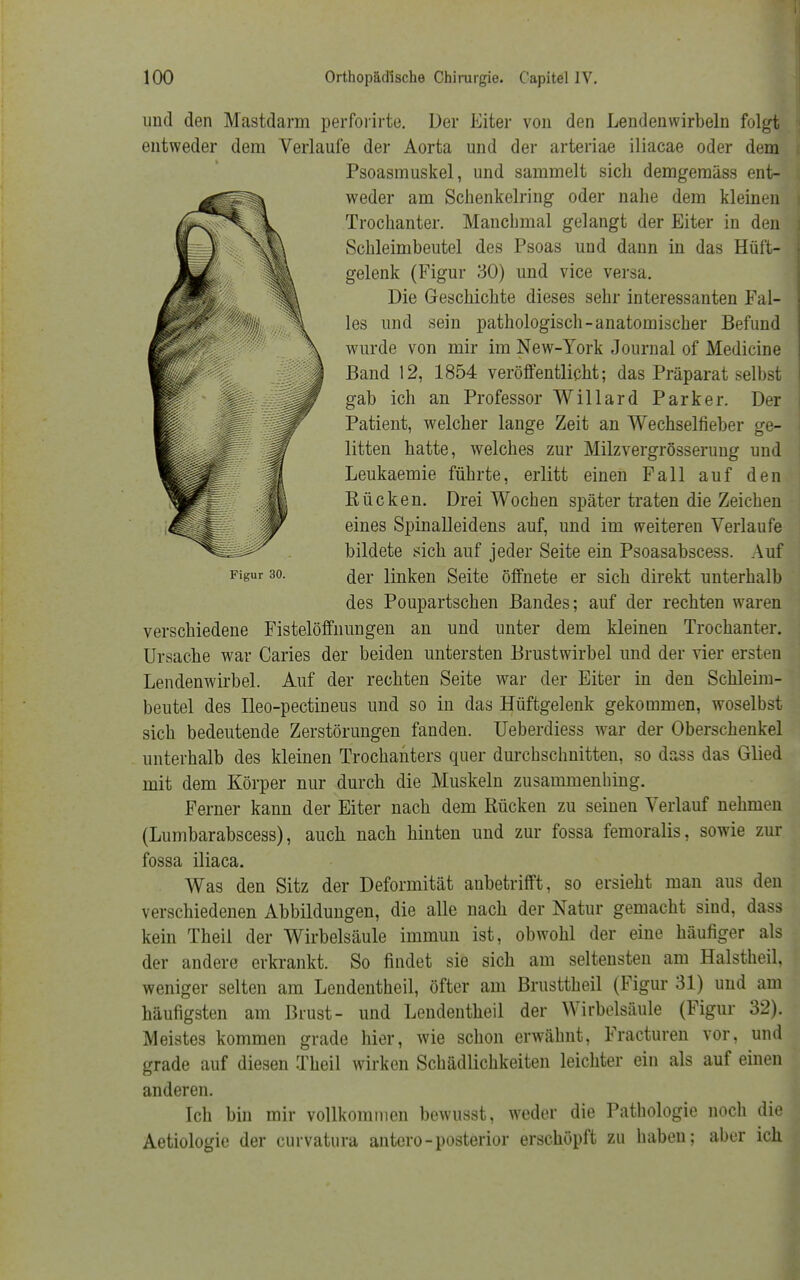 Figur 30. und den Mastdarm perforirte. Der Eiter von den Lendenwirbeln folgt entweder dem Verlaufe der Aorta und der arteriae iliacae oder dem Psoasmuskel, und sammelt sich demgemäss ent- weder am Schenkelring oder nahe dem kleinen Trochanter. Manchmal gelangt der Eiter in den Schleimbeutel des Psoas und dann in das Hüft- gelenk (Figur 30) und vice versa. Die Geschichte dieses sehr interessanten Fal- les und sein pathologisch-anatomischer Befund wurde von mir im New-York Journal of Medicine Band 12, 1854 veröffentlicht; das Präparat selbst gab ich an Professor Willard Parker. Der Patient, welcher lange Zeit an Wechselfieber ge- litten hatte, welches zur Milzvergrösserung und Leukaemie führte, erlitt einen Fall auf den Rücken. Drei Wochen später traten die Zeichen eines Spinalleidens auf, und im weiteren Verlaufe bildete sich auf jeder Seite ein Psoasabscess. Auf der linken Seite öffnete er sich direkt unterhalb des Poupartschen Bandes; auf der rechten waren verschiedene Fistelöffnungen an und unter dem kleinen Trochanter. Ursache war Caries der beiden untersten Brustwirbel und der vier ersten Lendenwirbel. Auf der rechten Seite war der Eiter in den Schleim- beutel des Ileo-pectineus und so in das Hüftgelenk gekommen, woselbst sich bedeutende Zerstörungen fanden. Ueberdiess war der Oberschenkel unterhalb des kleinen Trochanters quer durchschnitten, so dass das Glied mit dem Körper nur durch die Muskeln zusammenhing. Ferner kann der Eiter nach dem Bücken zu seinen Verlauf nehmen (Lumbarabscess), auch nach hinten und zur fossa femoralis, sowie zur fossa iliaca. Was den Sitz der Deformität anbetrifft, so ersieht man aus den verschiedenen Abbildungen, die alle nach der Natur gemacht sind, dass kein Theil der Wirbelsäule immun ist, obwohl der eine häufiger als der andere erkrankt. So findet sie sich am seltensten am Halstheil, weniger selten am Lendentheil, öfter am Brusttheil (Figur 31) und am häufigsten am Brust- und Lendentheil der Wirbelsäule (Figur 32). Meistes kommen grade hier, wie schon erwähnt, Fracturen vor, und grade auf diesen Theil wirken Schädlichkeiten leichter ein als auf einen anderen. Ich bin mir vollkommen bewusst, weder die Pathologie noch die Aetiologie der curvatura antero-posterior erschöpft zu haben; aber ick