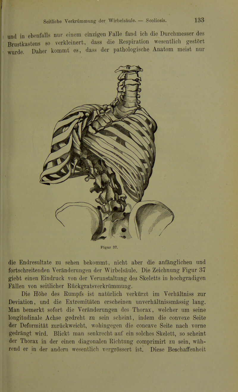 und in ebenfalls nur einem einzigen Falle fand ich die Durchmesser des Brustkastens so verkleinert, dass die Respiration wesentlich gestört wurde. Daher kommt es, dass der pathologische Anatom meist nur Figur 37 die Endresultate zu sehen bekommt, nicht aber die anfänglichen und fortschreitenden Veränderungen der Wirbelsäule. Die Zeichnung Figur 37 giebt einen Eindruck von der Verunstaltung de3 Skeletts in hochgradigen Fällen von seitlicher Rückgratsverkrümmung. Die Höhe des Rumpfs ist natürlich verkürzt im Verhältniss zur Deviation, und die Extremitäten erscheinen unverhältnissmässig lang. Man bemerkt sofort die Veränderungen des Thorax, welcher um seine longitudinale Achse gedreht zu sein scheint, indem die convexe Seite der Deformität zurückweicht, wohingegen die concave Seite nach vorne gedrängt wird. Blickt man senkrecht auf ein solches Skelett, so scheint der Thorax in der einen diagonalen Richtung comprimirt zu sein, wäh- rend er in der andern wesentlich vergrössert ist. Diese Beschaffenheit