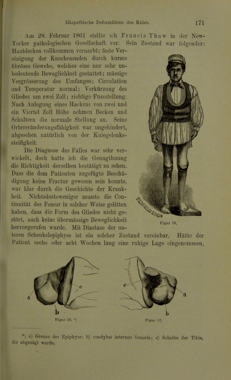 Am 28. Februar 1861 stellte ich Francis Thaw in der New- Yorker pathologischen Gesellschaft vor. Sein Zustand war folgender: Hautdecken vollkommen vernarbt; feste Ver- einigung der Knochenenden durch kurzes fibröses Gewebe, welches eine nur sehr un- bedeutende Beweglichkeit gestattet; massige Vergrößerung des Umfanges; Circulation und Temperatur normal; Verkürzung des Gliedes um zwei Zoll; richtige Fussstellung. Nach Anlegung eines Hackens von zwei und ein Viertel Zoll Höhe nehmen Becken und Schultern die normale Stellung an. Seine Ortsveränderungsfähigkeit war ungehindert, abgesehen natürlich von der Kniegelenks- steifigkeit. Die Diagnose des Falles war sehr ver- wickelt, doch hatte ich die Genugthuung die Richtigkeit derselben bestätigt zu sehen. Dass die dem Patienten zugefügte Beschä- digung keine Fractur gewesen sein konnte, war klar durch die Geschichte der Krank- heit. Nichtsdestoweniger musste die Con- tinuität des Femur in solcher Weise gelitten haben, dass die Form des Gliedes nicht ge- stört, auch keine übermässige Beweglichkeit hervorgerufen wurde. Mit Diastase der un- teren Schenkelepiphyse ist ein solcher Zustand vereinbar. Hätte der Patient sechs oder acht Wochen lang eine ruhige Lage eingenommen, Figur 57. *) a) Grenze der Epiphyse; b) condylus internus feraoris; c) Scheibe der Tibia, die abgesägt wurde.