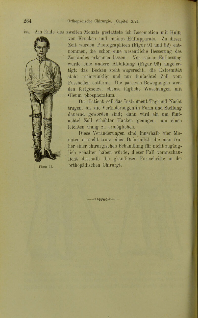 ist. Am Ende des zweiten Mouats gestattete ich Locomotion mit Hülfe von Krücken und meines Hüftapparats. Zu dieser Zeit wurden Photographieen (Figur 91 und 92) ent- nommen, die schon eine wesentliche Besserung des Zustandes erkennen lassen. Vor seiner Entlassung wurde eine andere Abbildung (Figur 93) angefer- tigt: das Becken steht wagerecht, die Extremität steht rechtwinklig und nur fünfachtel Zoll vom Fussboden entfernt. Die passiven Bewegungen wer- den fortgesetzt, ebenso tägliche Waschungen mit Oleum phosphoratum. Der Patient soll das Instrument Tag und Nacht tragen, bis die Veränderungen in Form und Stellung dauernd geworden sind; dann wird ein um fünf- achtel Zoll erhöhter Hacken genügen, um einen leichten Gang zu ermöglichen. Diese Veränderungen sind innerhalb vier Mo- naten erreicht trotz einer Deformität, die man frü- her einer chirurgischen Behandlung für nicht zugäng- lich gehalten haben würde; dieser Fall veranschau- licht desshalb die grandiosen Fortschritte in der Figur 93. orthopädischen Chirurgie.