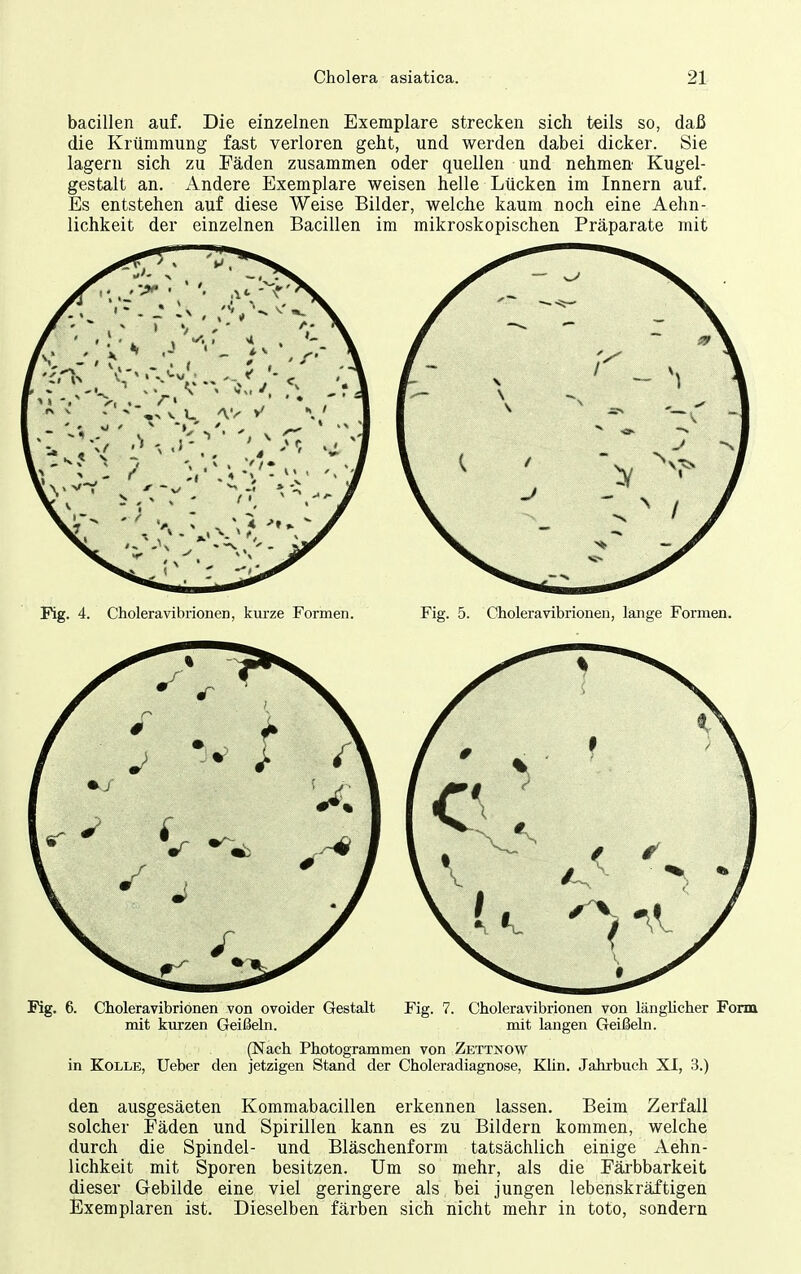 bacillen auf. Die einzelnen Exemplare strecken sich teils so, daß die Krümmung fast verloren geht, und werden dabei dicker. Sie lagern sich zu Fäden zusammen oder quellen und nehmen Kugel- gestalt an. Andere Exemplare weisen helle Lücken im Innern auf. Es entstehen auf diese Weise Bilder, welche kaum noch eine Aehn- lichkeit der einzelnen Bacillen im mikroskopischen Präparate mit Fig. 4. Choleravibrionen, kurze Formen. Fig. 5. Choleravibrioueu, lange Formen. Kg. 6. Choleravibrionen von ovoider Gestalt Fig. 7. Choleravibrionen von längUcher Form mit kurzen Geißeln. mit langen Geißeln. (Nach Photogrammen von Zettnow in KoLLE, Ueber den jetzigen Stand der Choleradiagnose, Klin. Jahrbuch XI, 3.) den ausgesäeten Kommabacillen erkennen lassen. Beim Zerfall solcher Fäden und Spirillen kann es zu Bildern kommen, welche durch die Spindel- und Bläschenform tatsächlich einige Aehn- lichkeit mit Sporen besitzen. Um so mehr, als die Färbbarkeit dieser Gebilde eine viel geringere als bei jungen lebenskräftigen Exemplaren ist. Dieselben färben sich nicht mehr in tote, sondern