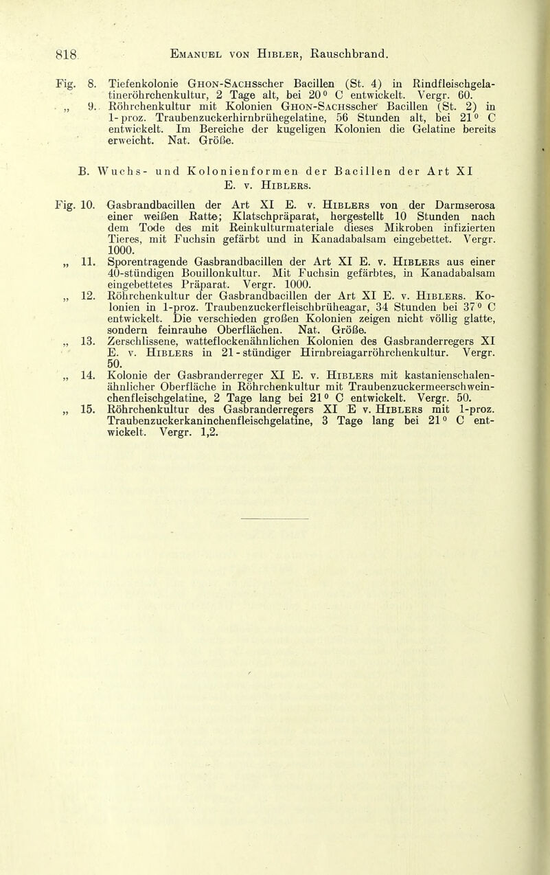 Fig. 8. Tiefenkolonie GnoN-SACHSscher Bacillen (St. 4) in Rindfleischgela- tinerölirchenkultur, 2 Tage alt, bei 20° C entwickelt. Vergr. 60. . „ 9. Röhrchenkultur mit Kolonien GnoN-SACHSscher Bacillen (St. 2) in 1-proz. Traubenzuckerhirnbrühegelatine, 56 Stunden alt, bei 21° C entwickelt. Im Bereiche der kugeligen Kolonien die Gelatine bereits erweicht. Nat. Größe. B. Wuchs- und Kolonienformen der Bacillen der Art XI E. V. HiBLERS. Fig. 10. Gasbrandbacillen der Art XI E. v. Hiblers von der Darmserosa einer weißen Hatte; Klatschpräparat, hergestellt 10 Stunden nach dem Tode des mit ßeinkulturmateriale dieses Mikroben infizierten Tieres, mit Fuchsin gefärbt und in Kanadabalsam eingebettet. Vergr. 1000. „ 11, Sporentragende Gasbrandbacillen der Art XI E. v. Hiblers aus einer 4Ü-stündigen Bouillonkultur. Mit Fuchsin gefärbtes, in Kanadabalsam eingebettetes Präparat. Vergr. 1000. „ 12. Röhrchenkultur der Gasbrandbacillen der Art XI E. v. Hiblers. Ko- lonien in 1-proz. Traubenzuckerfleischbrüheagar, 34 Stunden bei 37 o C entwickelt. Die verschieden großen Kolonien zeigen nicht völlig glatte, sondern feinrauhe Oberflächen. Nat. Größe. „ 13. Zerschlissene, watteflockenähnüchen Kolonien des Gasbranderregers XI E. V. Hiblers in 21 - stündiger Himbreiagarröhrchenkultur. Vergr. 50. „ 14. Kolonie der Gasbranderreger XI E. v. Hiblers mit kastanienschalen- ähnlicher Oberfläche in Röhrchenkultur mit Traubenzuckermeerschwein- chenfleischgelatine, 2 Tage lang bei 21° C entwickelt. Vergr. 50. „ 15. Röhrchenkultur des Gasbranderregers XI E v. Hiblers mit 1-proz. Traubenzuckerkaninchenfleischgelatine, 3 Tage lang bei 21 C ent- wickelt. Vergr. 1,2.