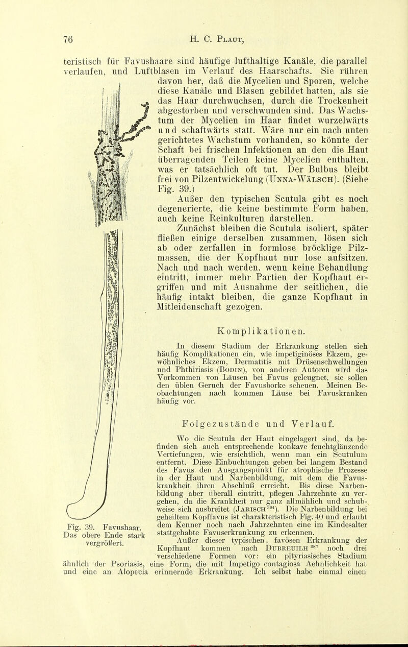 teristisch für Favushaare sind häufige lufthaltige Kanäle, die parallel verlaufen, und Luftblasen im Verlauf des Haarschafts. Sie rühren j davon her, daß die Myeelien und Sporen, welche diese Kanäle und Blasen gebildet hatten, als sie ^» das Haar durchwuchsen, durch die Trockenheit i abgestorben und verschwunden sind. Das Wachs- ^ tum der Myeelien im Haar findet wurzelwärts r^^ und schaftwärts statt. Wäre nur ein nach unten ' gerichtetes Wachstum vorhanden, so könnte der Schaft bei frischen Infektionen an den die Haut überragenden Teilen keine Myeelien enthalten, was er tatsächlich oft tut. Der Bulbus bleibt frei von Pilzentwickelung (Unna-Wälsch). (Siehe Fig. 39.) Außer den typischen Scutula gibt es noch degenerierte, die keine bestimmte Form haben, auch keine Reinkulturen darstellen. Zunächst bleiben die Scutula isoliert, später fließen einige derselben zusammen, lösen sich ab oder zerfallen in formlose bröcklige Pilz- massen, die der Kopfhaut nur lose aufsitzen. Nach und nach werden, wenn keine Behandlung eintritt, immer mehr Partien der Kopfhaut er- griifen und mit Ausnahme der seitlichen, die häufig intakt bleiben, die ganze Kopfliaut in Mitleidenschaft gezogen. Komplikationen. In diesem Stadium der Erkrankung stellen sich häufig Komplikationen ein, wie impetiginöses Ekzem, ge- wöhnliches Ekzem, Dermatitis mit Drüsenschwellungen und Phthiriasis (Bodin), von anderen Autoren wird das Vorkommen von Läusen bei Favus geleugnet, sie soUen den üblen Geruch der Favusborke scheuen. Meinen Be- obachtungen nach kommen Läuse bei Favuskranken häufig vor. Folgezustände und Verlauf. Wo die Scutula der Haut eingelagert sind, da be- finden sich auch entsprechende konkave feuchtgläuzende Vertiefungen, wie ersichtlich, wenn man ein Scutulum entfernt. Diese Einbuchtungen geben bei langem Bestand des Favus den Ausgangspunkt für atrophische Prozesse in der Haut und Narbenbildun^, mit dem die Favus- krankheit ihren Abschluß erreic'ht. Bis diese Narben- bildung aber überall eintritt, pflegen Jahrzehnte zu ver- gehen, da die Krankheit nur ganz allmählich und schub-, weise sich ausbreitet (Jarisch ■'^). Die Narbenbildung bei geheiltem Kopffavus ist charakteristisch Fig. 40 und erlaubt dem Kenner noch nach Jahrzehnten eine im Kindesalter stattgehabte Favuserkrankung zu erkennen. Außer dieser typischen. favösen Erkrankung der Kopfhaut kommen nach Dübreuilh noch drei verschiedene Formen vor: ein pityriasisches Stadium ähnlich der Psoriasis, eine Form, die mit Impetigo contagiosa Aehnlichkeit hat und eine an Alopecia erinnernde Erkrankung. Ich selbst habe einmal emen Fig. 39. Favushaar. Das obere Ende stark vergrößert.