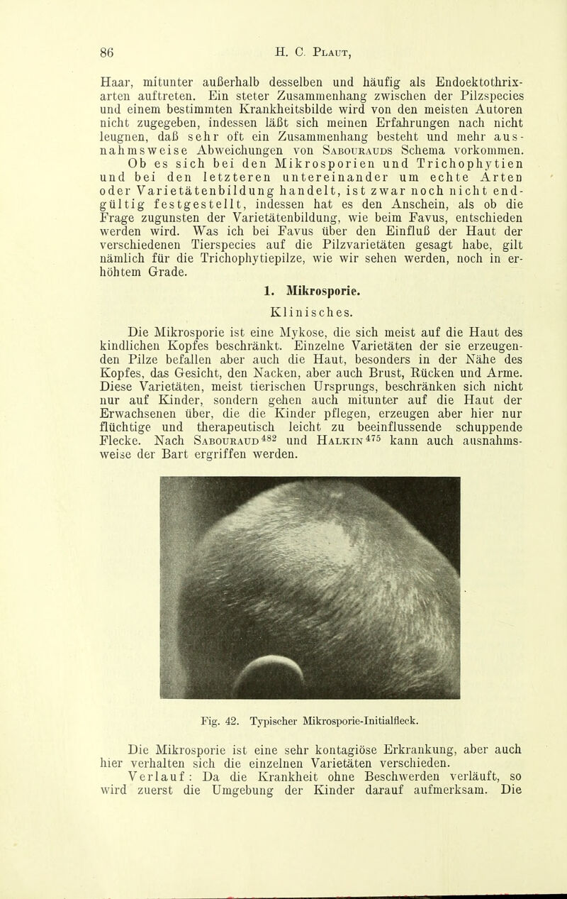 Haar, mitunter außerhalb desselben und häufig als Endoektothrix- arten auftreten. Ein steter Zusammenhang zwischen der Pilzspecies und einem bestimmten Krankheitsbilde wird von den meisten Autoren nicht zugegeben, indessen läßt sich meinen Erfahrungen nach nicht leugnen, daß sehr oft ein Zusammenhang besteht und mehr aus- nahmsweise Abweichungen von Saboueauds Schema vorkommen. Ob es sich bei den Mikrosporien und Trichophytien und bei den letzteren untereinander um echte Arten oder Varietätenbildung handelt, ist zwar noch nicht end- gültig festgestellt, indessen hat es den Anschein, als ob die Frage zugunsten der Varietätenbildung, wie beim Favus, entschieden werden wird. Was ich bei Favus über den Einfluß der Haut der verschiedenen Tierspecies auf die Pilzvarietäten gesagt habe, gilt nämlich für die Trichophytiepilze, wie wir sehen werden, noch in er- höhtem Grade. 1. Mikrosporie. Klinisches. Die Mikrosporie ist eine Mykose, die sich meist auf die Haut des kindlichen Kopfes beschränkt. Einzelne Varietäten der sie erzeugen- den Pilze befallen aber auch die Haut, besonders in der Nähe des Kopfes, das Gesicht, den Nacken, aber auch Brust, Rücken und Arme. Diese Varietäten, meist tierischen Ursprungs, beschränken sich nicht nur auf Kinder, sondern gehen auch mitunter auf die Haut der Erwachsenen über, die die Kinder pflegen, erzeugen aber hier nur flüchtige und therapeutisch leicht zu beeinflussende schuppende Flecke. Nach Sabouraud^82 y^fj Halkin*'^^ kann auch ausnahms- weise der Bart ergriffen werden. Fig. 42. Typischer Mikrosporie-Initialfleck. Die Mikrosporie ist eine sehr kontagiöse Erkrankung, aber auch hier verhalten sich die einzelnen Varietäten verschieden. Verlauf : Da die Krankheit ohne Beschwerden verläuft, so wird zuerst die Umgebung der Kinder darauf aufmerksam. Die