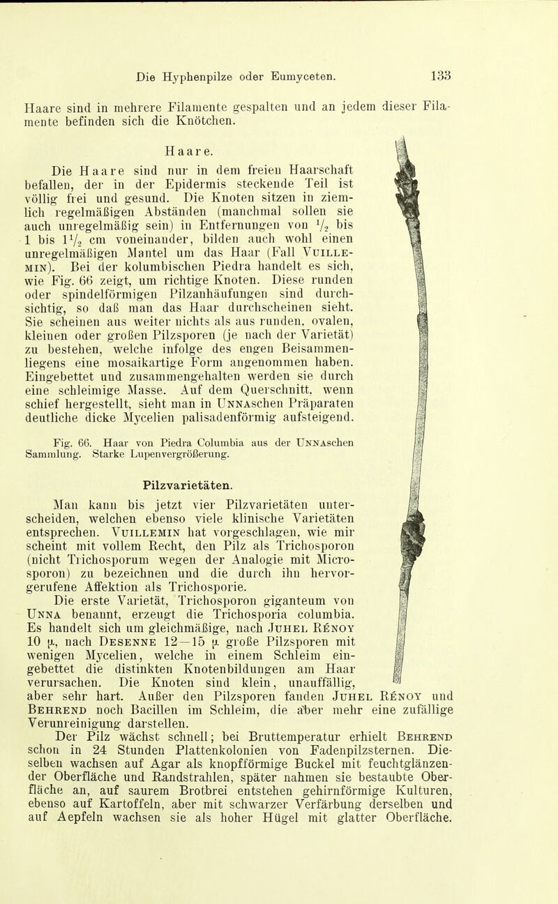 Haare sind in mehrere Filamente gespalten und an jedem dieser Fila- mente befinden sich die Knötchen. Haare. Die Haare sind nur in dem freien Haarschaft befallen, der in der Epidermis steckende Teil ist völlig- frei und gesund. Die Knoten sitzen in ziem- lich regelmäßigen Abständen (manchmal sollen sie auch unregelmäßig sein) in Entfernungen von V2 bis 1 bis IV2 cm voneinander, bilden auch wohl einen unregelmäßigen Mantel um das Haar (Fall Vuille- min). Bei der kolumbischen Piedra handelt es sich, wie Fig. 66 zeigt, um richtige Knoten. Diese runden oder spindelförmigen Pilzanhäufungen sind durch- sichtig, so daß man das Haar durchscheinen sieht. Sie scheinen aus weiter nichts als aus runden, ovalen, kleinen oder großen Pilzsporen (je nach der Varietät) zu bestehen, welche infolge des engen Beisammen- liegens eine mosaikartige Form angenommen haben. Eingebettet und zusammengehalten werden sie durch eine schleimige Masse. Auf dem Querschnitt, wenn schief hergestellt, sieht man in ÜNNAschen Präparaten deutliche dicke Mycelien palisadenförmig aufsteigend. Fig. 66. Haar von Piedra Columbia aus der ÜNNASchen Sammlung. Starke Lupenvergrößerung. Pilzvarietäten. Man kann bis jetzt vier Püzvarietäten unter- scheiden, welchen ebenso viele klinische Varietäten entsprechen. Vuillemin hat vorgeschlagen, wie mir scheint mit vollem Recht, den Pilz als Trichosporon (nicht Trichosporum wegen der Analogie mit Micro- sporon) zu bezeichnen und die durch ihn hervor- gerufene Aifektion als Trichosporie. Die erste Varietät, Trichosporon giganteum von I Unna benannt, erzeugt die Trichosporia columbia. ij| Es handelt sich um gleichmäßige, nach Juhel Renoy jß^ 10 [X, nach Desenne 12 — 15 |j. große Pilzsporen mit 4 wenigen Mycelien, welche in einem Schleim ein- gebettet die distinkten Knotenbilduugeu am Haar 1 verursachen. Die Knoten sind klein, unauffällig, '^'^ aber sehr hart. Außer den Pilzsporen fanden Juhel Renoy und Behrend noch Bacillen im Schleim, die aber mehr eine zufällige Verunreinigung darstellen. Der Pilz wächst schnell; bei Bruttemperatur erhielt Behrend schon in 24 Stunden Plattenkolonien von Fadenpilzsternen. Die- selben wachsen auf Agar als knopfförmige Buckel mit feuchtglänzen- der Oberfläche und Randstrahlen, später nahmen sie bestaubte Ober- fläche an, auf saurem Brotbrei entstehen gehirnförmige Kulturen, ebenso auf Kartoffeln, aber mit schwarzer Verfärbung derselben und auf Aepfeln wachsen sie als hoher Hügel mit glatter Oberfläche.