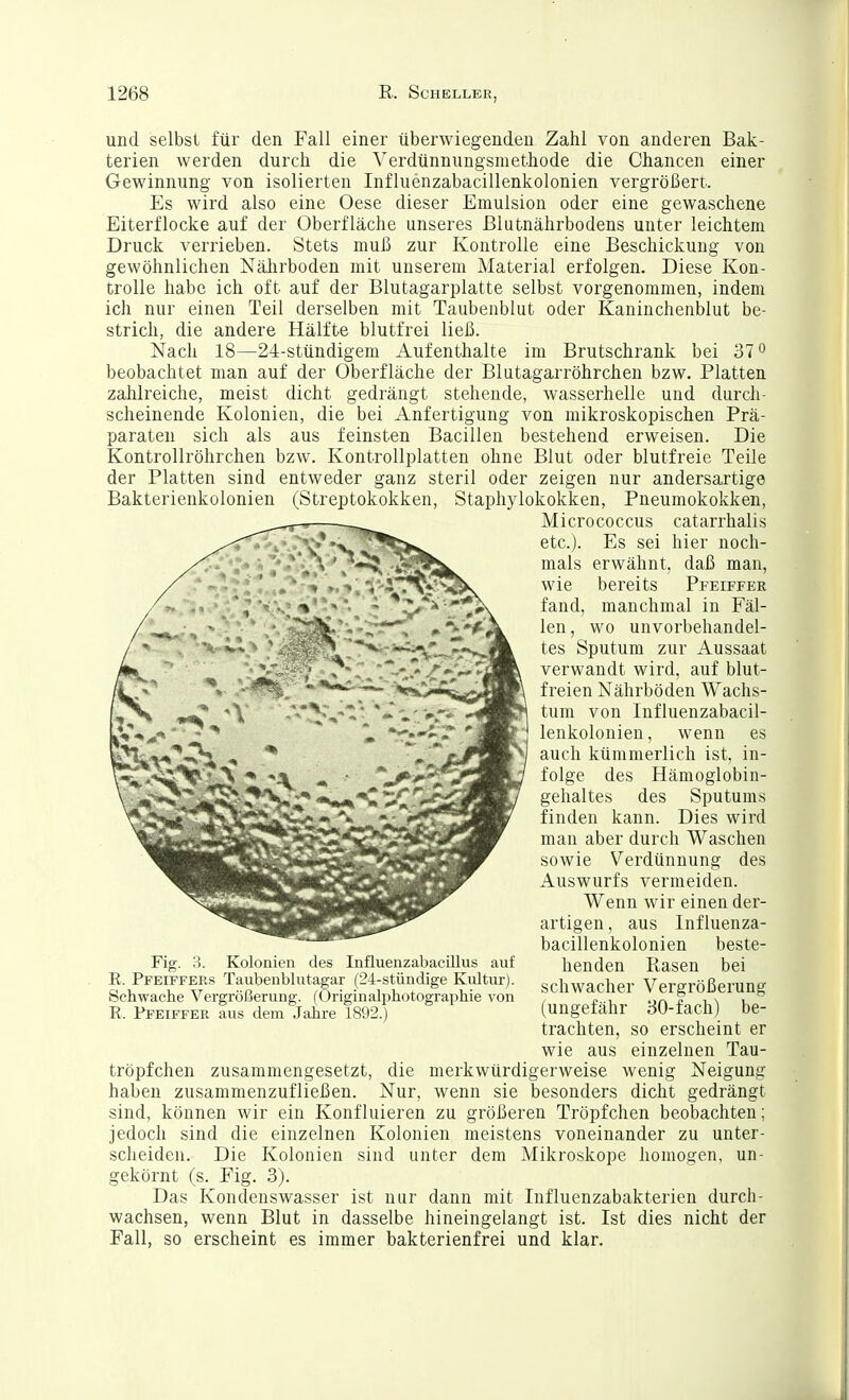und selbsl für den Fall einer überwiegenden Zahl von anderen Bak- terien werden durch die \^erdünnungsniethode die Chancen einer Gewinnung von isolierten Influenzabacillenkolonien vergrößert. Es wird also eine Oese dieser Emulsion oder eine gewaschene Eiterflocke auf der Oberfläche unseres ßlutnährbodens unter leichtem Druck verrieben. Stets muß zur Kontrolle eine Beschickung von gewöhnlichen Nährboden mit unserem Material erfolgen. Diese Kon- trolle habe ich oft auf der Blutagarplatte selbst vorgenommen, indem ich nur einen Teil derselben mit Taubenblut oder Kaninchenblut be- strich, die andere Hälfte blutfrei ließ. Nach 18—24-stündigem Aufenthalte im Brutschrank bei 37 ^ beobachtet man auf der Oberfläche der Blutagarröhrchen bzw. Platten zahlreiche, meist dicht gedrängt stehende, Avasserhelle und durch- scheinende Kolonien, die bei Anfertigung von mikroskopischen Prä- paraten sich als aus feinsten Bacillen bestehend erweisen. Die Kontrollröhrchen bzw. Kontrollplatten ohne Blut oder blutfreie Teile der Platten sind entweder ganz steril oder zeigen nur andersartige Bakterienkolonien (Streptokokken, Staphylokokken, Pneumokokken, Micrococcus catarrhalis etc.). Es sei hier noch- mals erwähnt, daß man, wie bereits Pfeiffer fand, manchmal in Fäl- len , wo unvorbehandel- tes Sputum zur Aussaat verwandt wird, auf blut- freien Nährböden Wachs- tum von Influenzabacil- lenkolonien , wenn es auch kümmerlich ist, in- folge des Hämoglobin- gehaltes des Sputums finden kann. Dies wird man aber durch Waschen sowie Verdünnung des Auswurfs vermeiden. Wenn wir einen der- artigen , aus Influenza- bacillenkolonien beste- Fig. 3. Kolonien des Influenzabacülus auf henden Rasen bei E. Pfeiffers Taubenblutagar (24-stündige Kiütur). schwacher Vergrößerung öcnwache Vergrößerung. (Originalpnotograiiliie von , „., .,r> ? i \ i E. Pfeiffer aus dem Jahre 1892.) (ungefähr 30-fach) be- trachten, so erscheint er wie aus einzelnen Tau- tröpfchen zusammengesetzt, die merkwürdigerweise wenig Neigung haben zusammenzufließen. Nur, wenn sie besonders dicht gedrängt sind, können wir ein Konfluieren zu größeren Tröpfchen beobachten; jedoch sind die einzelnen Kolonien meistens voneinander zu unter- scheiden. Die Kolonien sind unter dem Mikroskope homogen, un- gekörnt (s. Fig. 3). Das Kondenswasser ist nur dann mit Influenzabakterien durch- wachsen, wenn Blut in dasselbe hineingelangt ist. Ist dies nicht der Fall, so erscheint es immer bakterienfrei und klar.