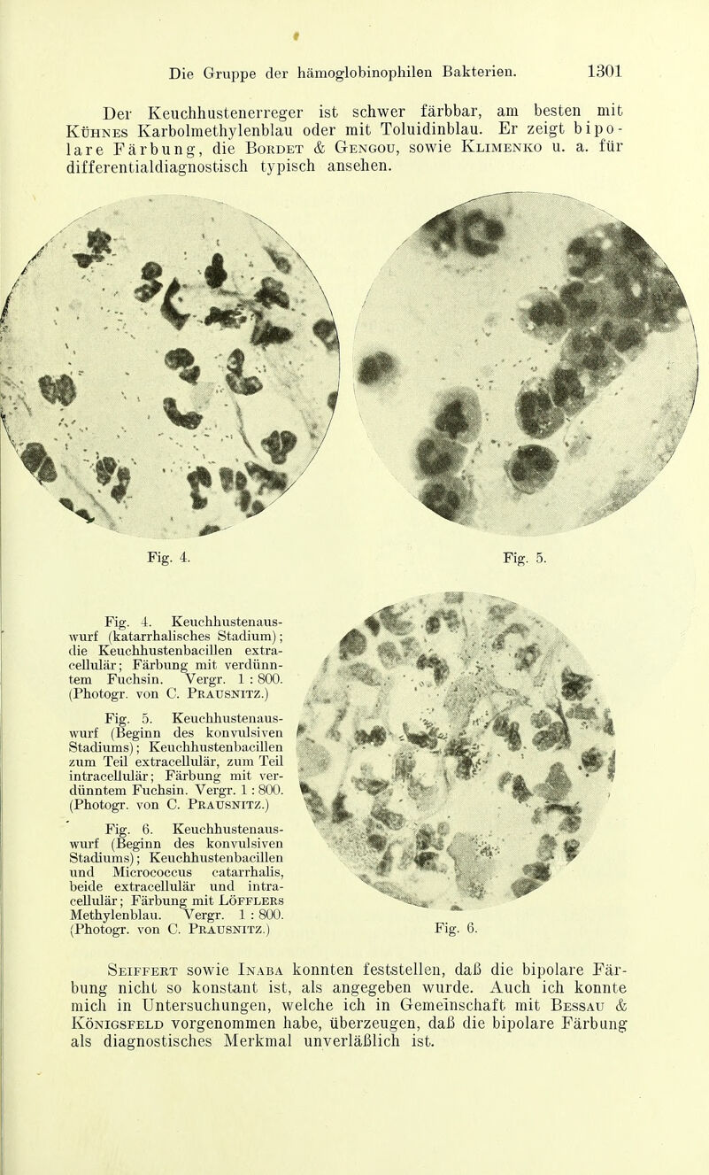 Der Keuchhustenerreger ist schwer färbbar, am besten mit Kühnes Karbolmethylenblau oder mit Toluidinblau. Er zeigt bipo- lare Färbung, die Bürdet & Gengou, sowie Klimenko u. a. für differentialdiagnostisch typisch ansehen. Fig. 4. Fig. 5. Fig. 4. Keiichhustenaus- wurf (katarrhalisches Stadium); die Keuchhustenbacillen extra- cellulär; Färbung mit verdünn- tem Fuchsin. Vergr. 1 : 800. (Photogr. von C. Prausnitz.) Fig. 5. Keuchhustenaus- wurf (Beginn des konvulsiven Stadiums); Keuchhustenbacillen zum Teil extracellulär, zum Teil intracelliüär; Färbung mit ver- dünntem Fuchsin. Vergr. 1: 800. (Photogr. von C. Praxjsnitz.) Fig. 6. Keuchhustenaus- wurf (Beginn des konvidsiven Stadiums); Keuchhustenbacillen und Micrococcus catarrhalis, beide extracellrdär und intra- ceUulär; Färbung mit Löfflers Methylenblau. Vergr. 1 : 800. (Photogr. von C. Prausnitz.) Fig. 6. Seiffeet sowie Inaba konnten feststellen, daß die bipolare Fär- bung nicht so konstant ist, als angegeben wurde. Auch ich konnte mich in Untersuchungen, welche ich in Gemeinschaft mit Bessau & Königsfeld vorgenommen habe, überzeugen, daß die bipolare Färbung als diagnostisches Merkmal unverläßlich ist.