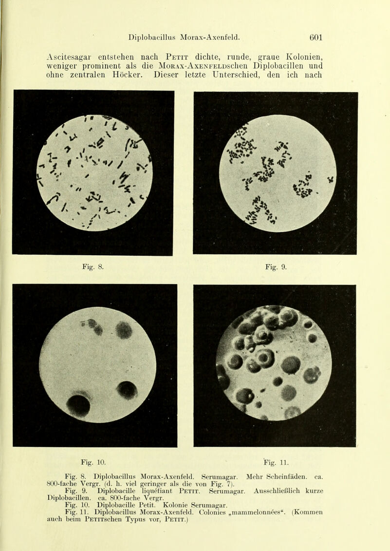 Ascitesagar entstehen nach Petit dichte, runde, graue Kolonien, weniger prominent als die MoRAX-AxENi-ELDSchen Diplobacillen und ohne zentralen Höcker. Dieser letzte Unterschied, den ich nach Fig. 10. Fig. 11. Fig. 8. Diplobacillus Morax-Axenfeld. Herumagar. Mehr Scheinfäden, ca. 800-fache Vergr. (d. h. viel geringer als die von Fig. 7). Fig. 9. Diplobacille liquetiant Petit. Seruniagar. Ausschließlich kurze Diplobacillen. ca. 800-fache Vergr. Fig. 10. Diplobacille Petit. Kolonie Serumagar. Fig. 11. Diplobacillus Morax-Axenfeld. Colonies „mammelonnees. (Kommen auch beim PETiTschen Typus vor, Petit.)