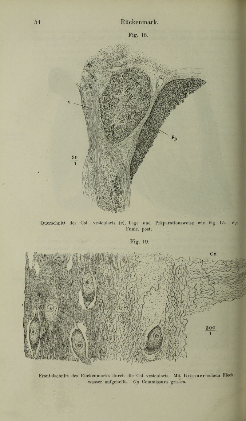 Fig. 18. Querschnitt der Col. vesicularis (v), Lage und Präparationsweise wie Fig. 15. J'p Funic. post. Fig. 19. Frontalschnitt des Rückenmarks durch die Col. vesicularis. Mit Brönner’schem Fleck- wasser aufgehellt. Cg Commissura grissea.