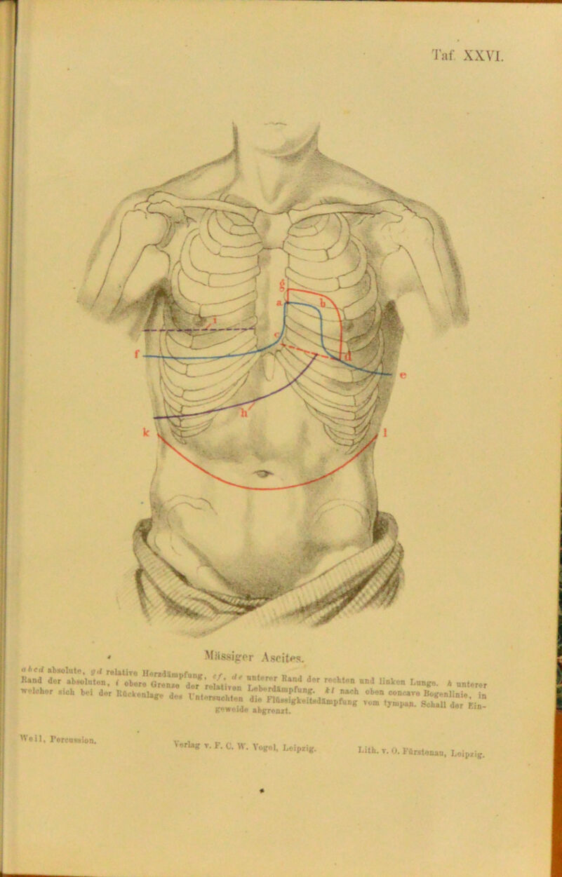 « Massiger Ascites. Iiand «lH»Uteiirn!ler”c’r.UtiT« 1b ri»**r* ,Ata“ BnJ ,inVen I'nn^' h unterer W^r ** ” -R— *■ ~ Ä5ST«i e i I, Percussion.