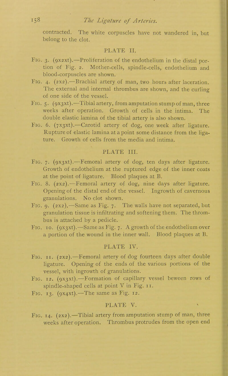 contracted. The white corpuscles have not wandered in, but belong to the clot. PLATE II. Fig. 3. (9_\2xt).—Proliferation of the endothelium in the distal por- tion of Fig. 2. Mother-cells, spindle-cells, endothelium and blood-corpuscles are shown. Fig. 4. (2x2).—Brachial artery of man, two hours after laceration. The external and internal thrombus are shown, and the curling of one side of the vessel. Fig. 5. (9x3x1).—Tibial artery, from amputation stump of man, three weeks after operation. Growth of cells in the intima. The double elastic lamina of the tibial artery is also shown. Fig. 6. (7x3x1).—Carotid artery of dog, one week after ligature. Rupture of elastic lamina at a point some distance from the liga- ture. Growth of cells from the media and intima. PLATE III. Fig. 7. (9x3x1).—Femoral artery of dog, ten days after ligature. Growth of endothelium at the ruptured edge of the inner coats at the point of ligature. Blood plaques at B. Fig. 8. (2x2).-—Femoral artery of dog, nine days after ligature. Opening of the distal end of the vessel. Ingrowth of cavernous granulations. No clot shown. Fig. 9. (2x2).—Same as Fig. 7. The walls have not separated, but granulation tissue is infiltrating and softening them. The throm- bus is attached by a pedicle. Fig. 10. (9x3x1).—SameasFig. 7. A growth of the endothelium over a portion of the wound in the inner wall. Blood plaques at B. PLATE IV. Fig. ii. (2x2).—Femoral artery of dog fourteen days after double ligature. Opening of the ends of the various portions of the vessel, with ingrowth of granulations. Fig. 12. (9X3xt).—Formation of capillary vessel beween rows of spindle-shaped cells at point V in Fig. 11. Fig. 13. (9x4x1).—The same as Fig. 12. PLATE V. Fig. 14. (2x2).—Tibial artery from amputation stump of man, three weeks after operation. Thrombus protrudes from the open end