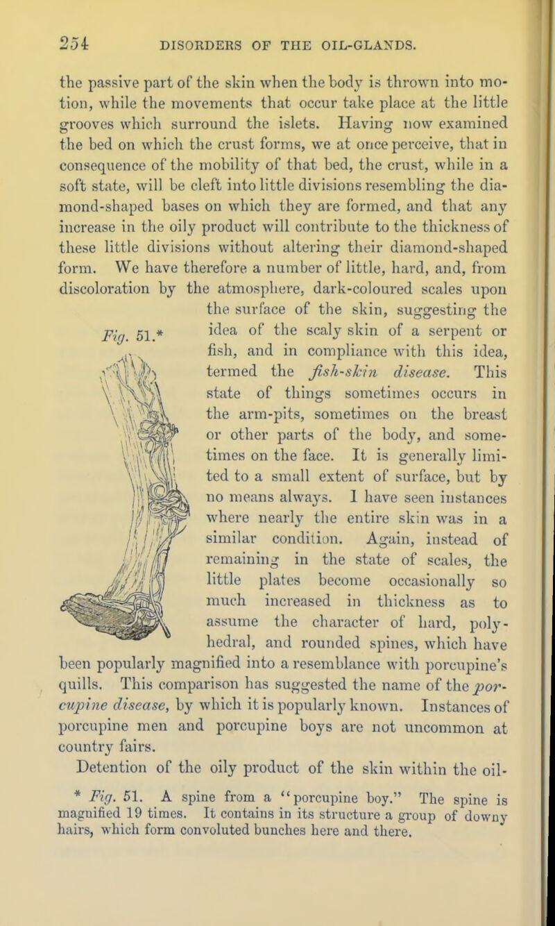 the passive part of the skin when the body is thrown into mo- tion, while the movements that occur take place at the little grooves which surround the islets. Having now examined the bed on which the crust forms, we at once perceive, that in consequence of the mobility of that bed, the crust, while in a soft state, will be cleft into little divisions resembling the dia- mond-shaped bases on which they are formed, and that any increase in the oily product will contribute to the thickness of these little divisions without altering their diamond-shaped form. We have therefore a number of little, hard, and, from discoloration by the atmosphere, dark-coloured scales upon the surface of the skin, suggesting the Fig 51 * ^^^'^ ^''^ scaly skin of a serpent or fish, and in compliance with this idea, termed the Jish-skin disease. This state of things sometimes occurs in the arm-pits, sometimes on the breast or other parts of the body, and some- times on the face. It is generally limi- ted to a small extent of surface, but by no means always. 1 have seen instances where nearly the entire skin was in a similar condition. Again, instead of remaining in the state of scales, the little plates become occasionall}^ so much increased in thickness as to assume the character of hard, poly- hedral, and rounded spines, which have been popularly magnified into a resemblance with porcupine's quills. This comparison has suggested the name of the poi^- cupine disease, by which it is popularly known. Instances of porcupine men and porcupine boys are not uncommon at country fairs. Detention of the oily product of the skin within the oil- * Fig. 51. A spine from a porcupine boy. The spine is magnified 19 times. It contains in its structure a group of downy hairs, which form convoluted bunches here and there.