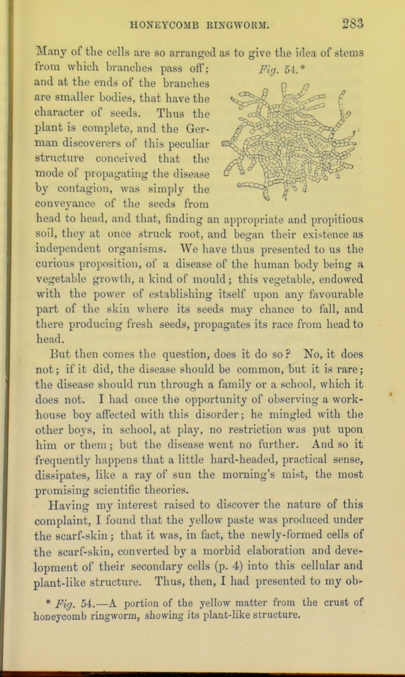 Many of the cells are so arranged as to give tlie idea of stems from which branches pass off; and at the ends of the branches are smaller bodies, that have the character of seeds. Thus the plant is complete, and the Ger- man discoverers of this peculiar structure conceived that the mode of propagating the disease by contagion, was simply the conveyance of the seeds from head to head, and that, finding an appropriate and propitious soil, they at once struck root, and began their existence as independent organisms. We have thus presented to us the curious proposition, of a disease of the human body being a vegetable growth, a kind of mould; this vegetable, endowed with the power of establishing itself upon any favourable part of the skin where its seeds may chance to fall, and there producing fresh seeds, propagates its race from head to head. But then comes the question, does it do so ? No, it does not; if it did, the disease should be common, but it is rare; the disease should run through a family or a school, which it does not. I had once the opportunity of observing a work- house boy affected with this disorder; he mingled with the other boys, in school, at play, no restriction was put upon him or them ; but the disease went no further. And so it frequently happens that a little hard-headed, practical sense, dissipates, like a ray of sun the morning's mist, the most promising scientific theories. Having my interest raised to discover the nature of this complaint, I found that the yellow paste was produced under the scarf-skin; that it was, in fact, the newly-formed cells of the scarf-skin, converted by a morbid elaboration and deve- lopment of their secondary cells (p. 4) into this cellular and plant-like structure. Thus, then, I had presented to my ob- * Fig. 54.—A portion of the yellow matter from the crust of honeycomb ringworm, showing its plant-like structure.